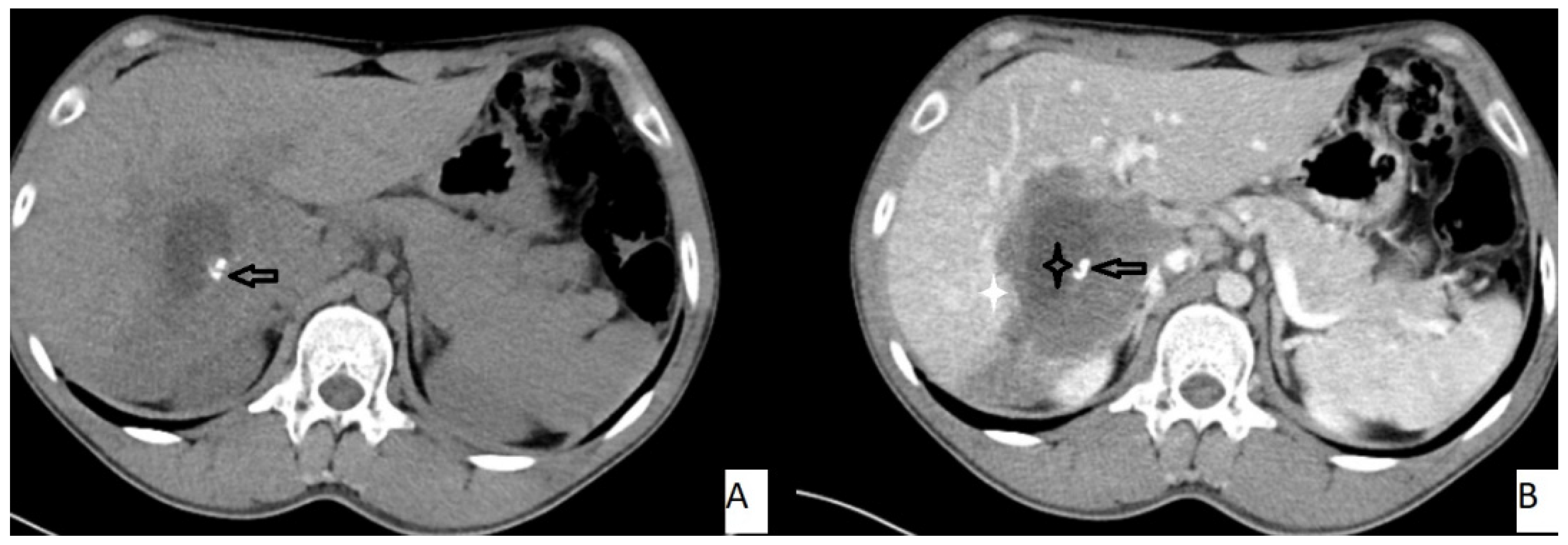 Pathogens 11 00276 g003
