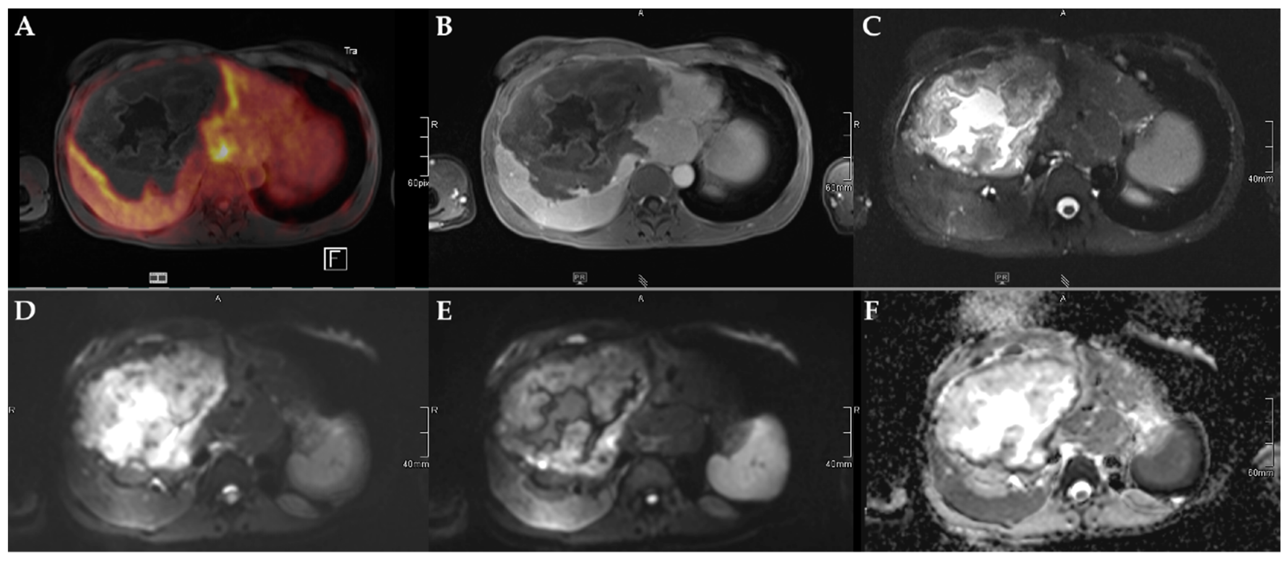 Pathogens 11 00348 g003