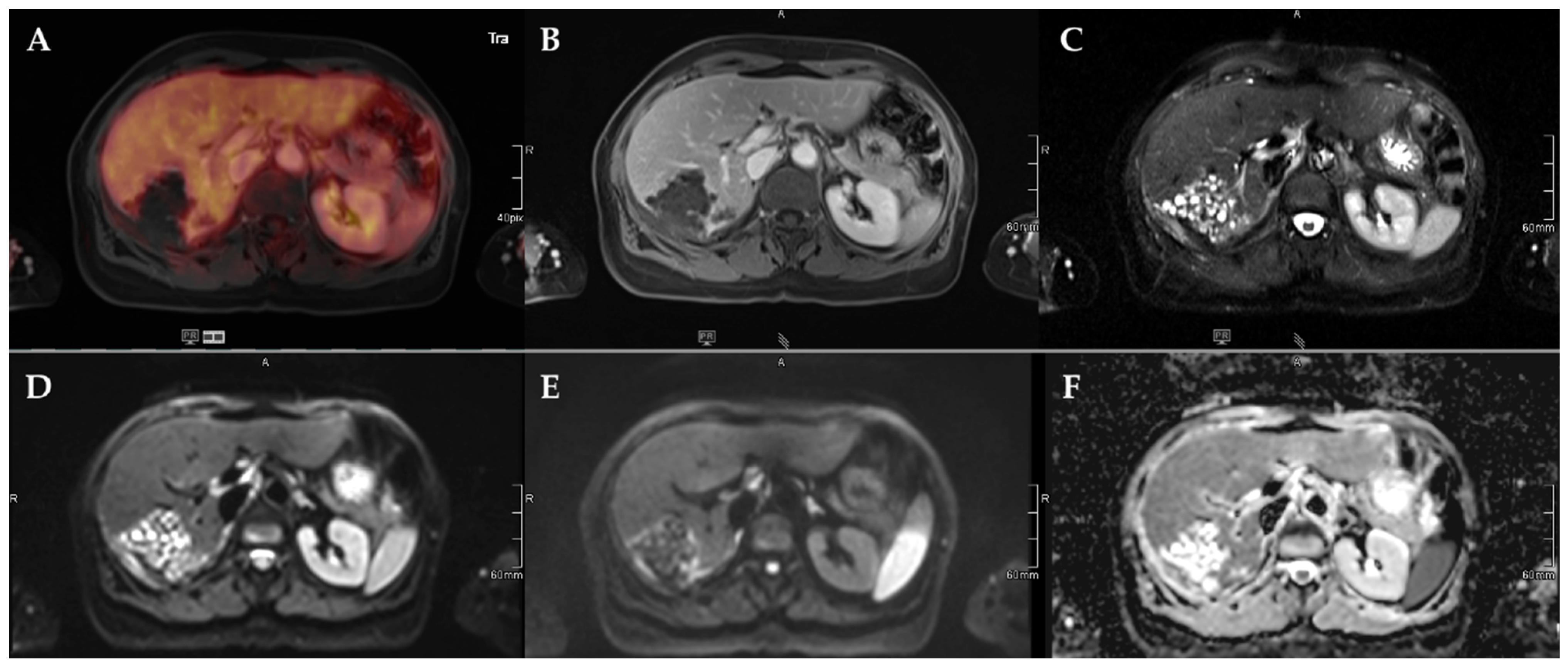 Pathogens 11 00348 g004
