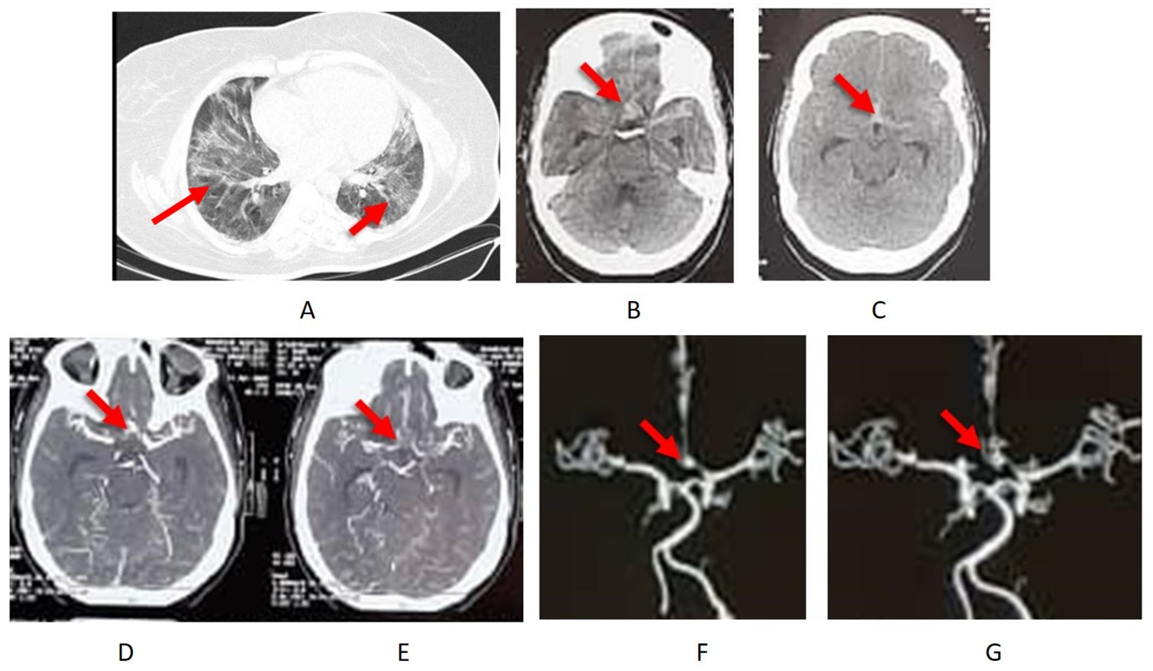 Pathogens 11 00617 g001