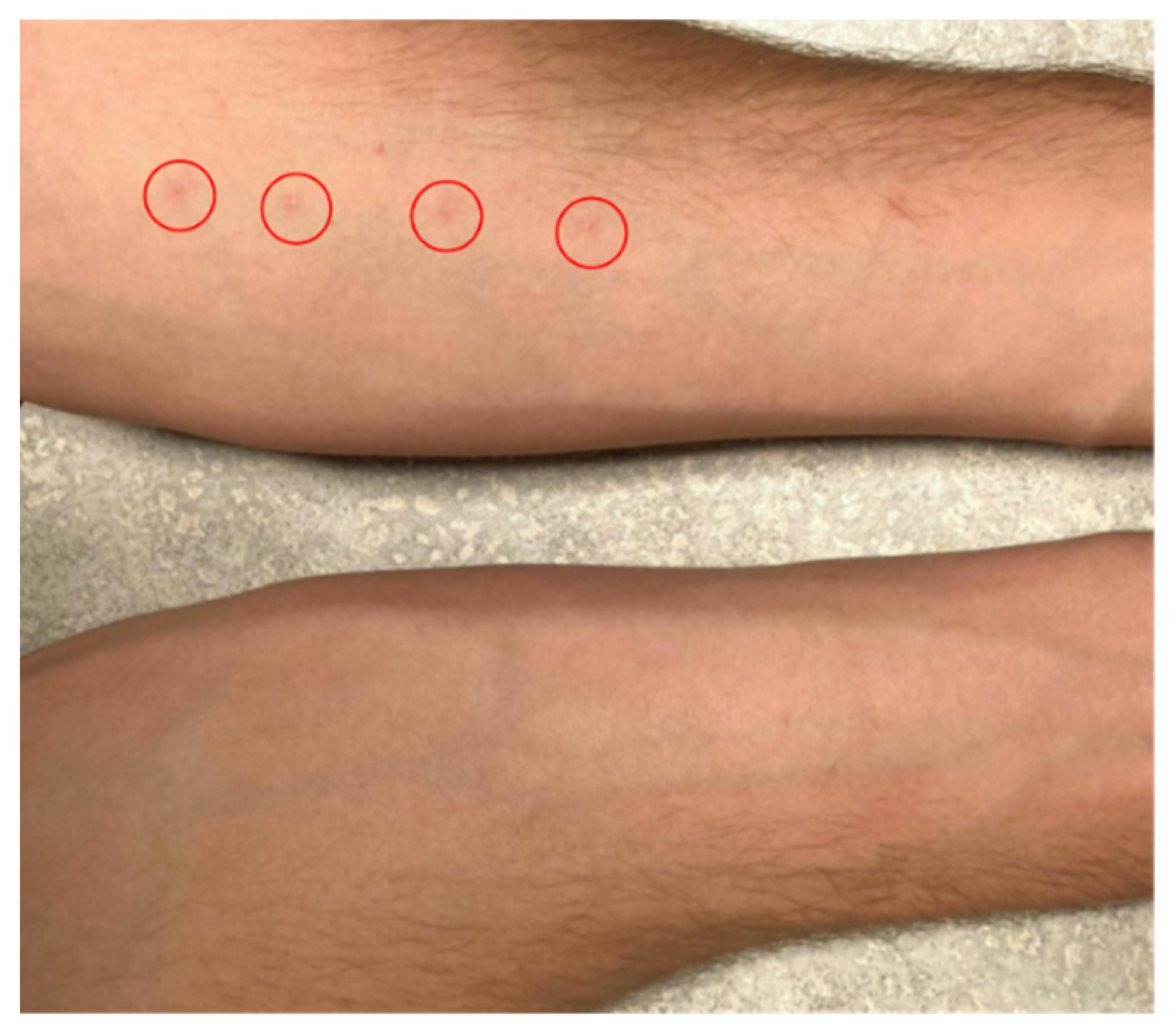 Pathogens 11 00651 g001