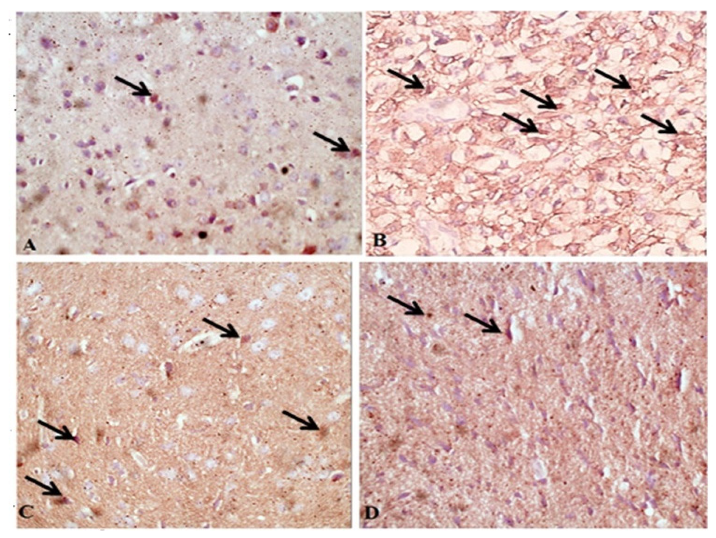 Pathogens 11 00798 g005