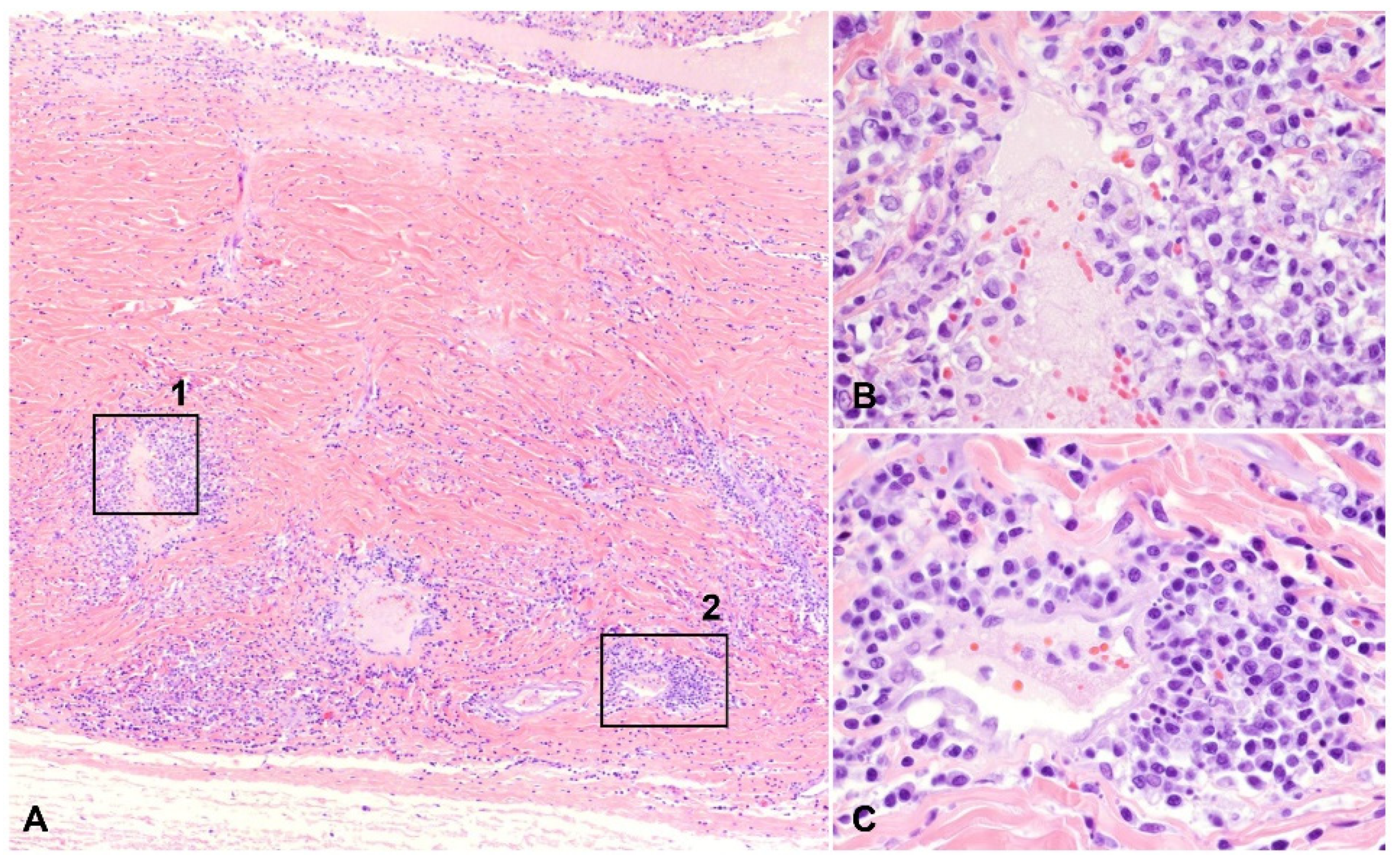 Pathogens 11 00883 g003