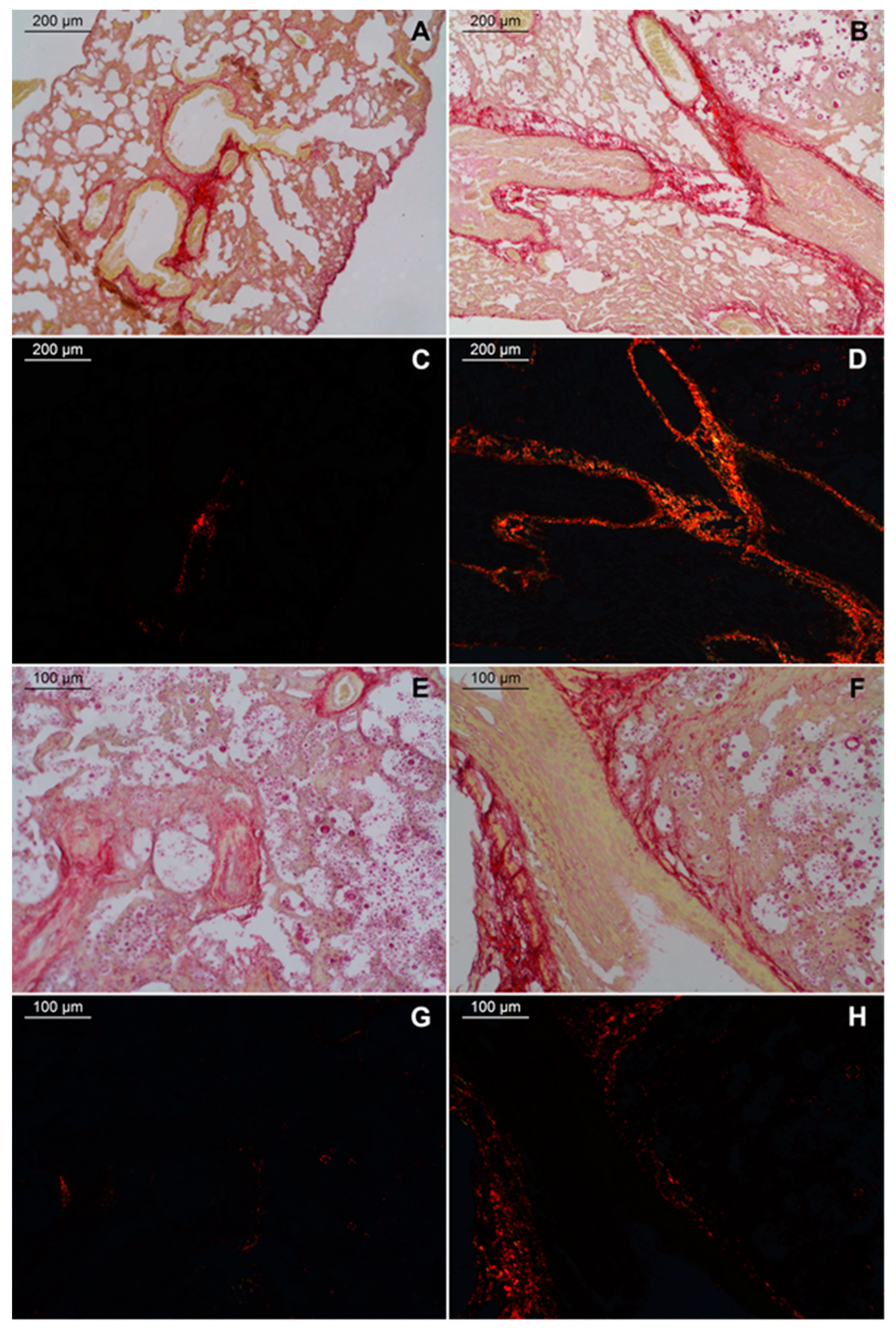 Pathogens 11 00987 g004
