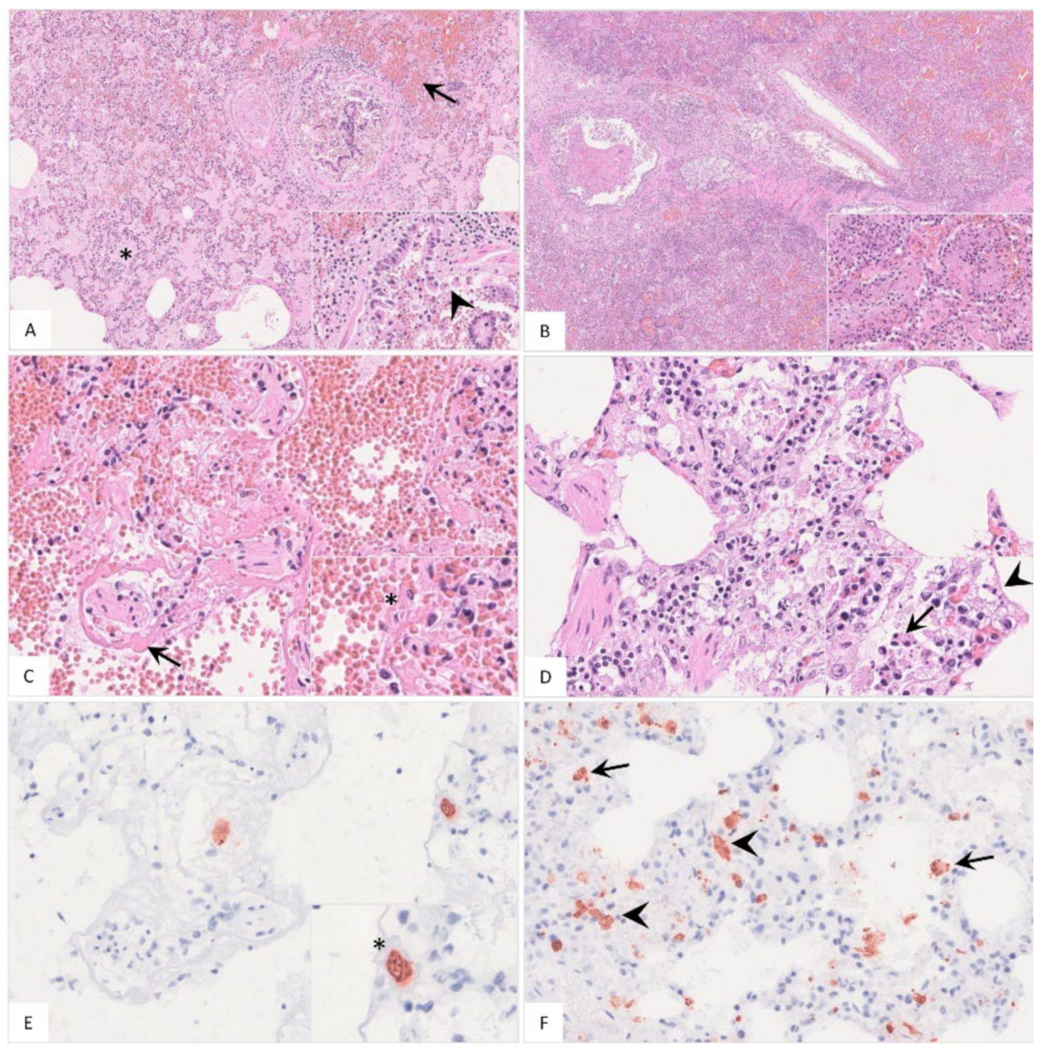 Pathogens 11 01386 g007 Pathogens 11 01386 g007