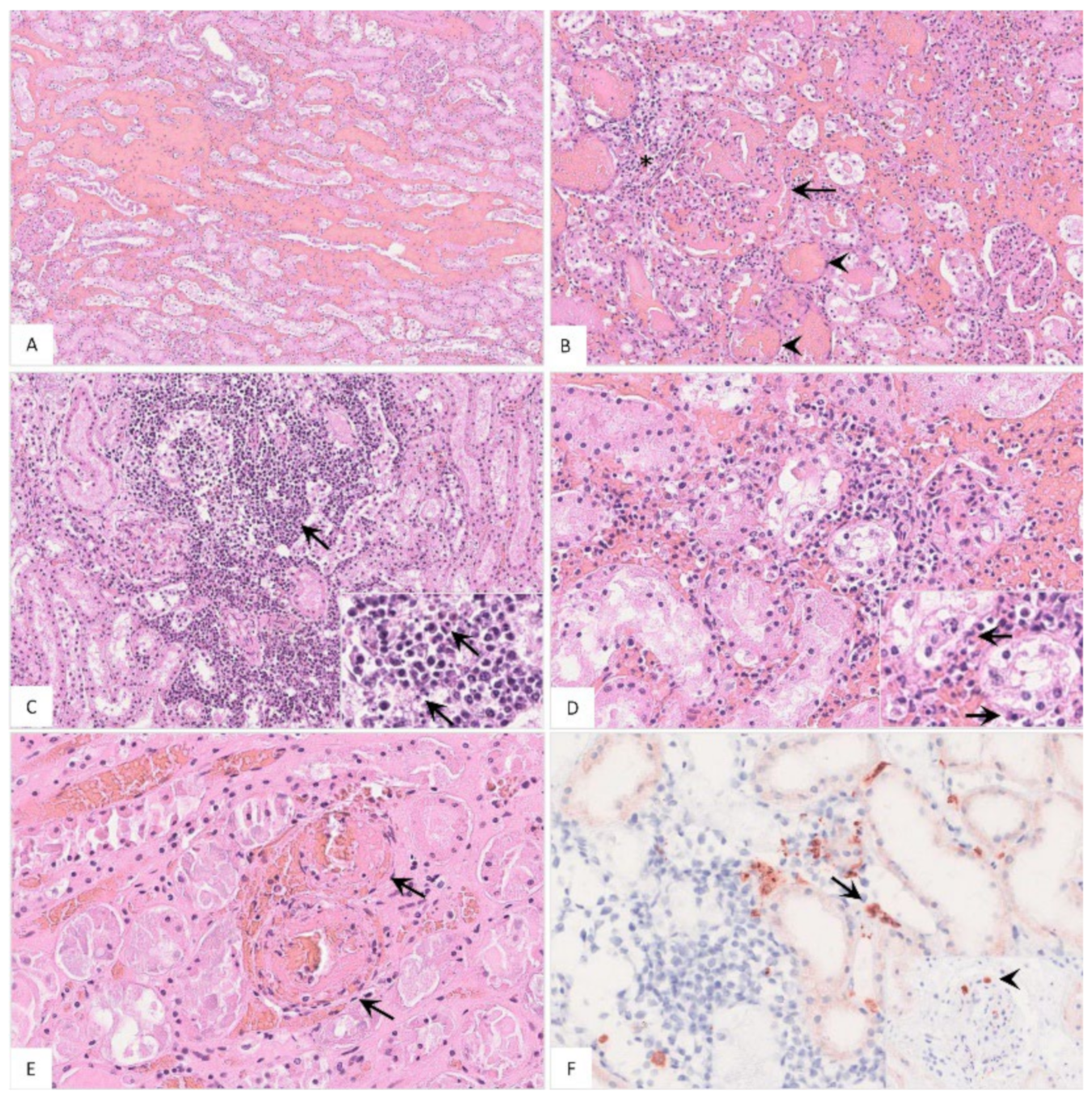 Pathogens 11 01386 g011 Pathogens 11 01386 g011