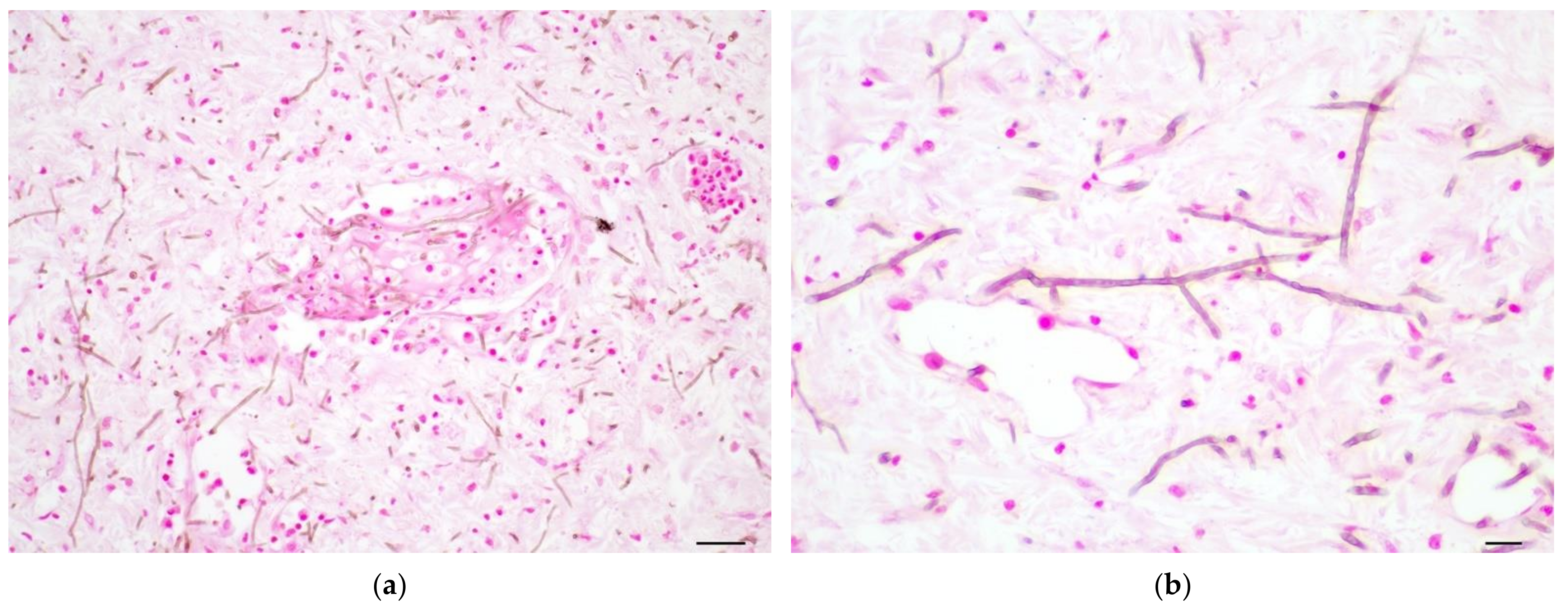Pathogens 11 01401 g003 Pathogens 11 01401 g003