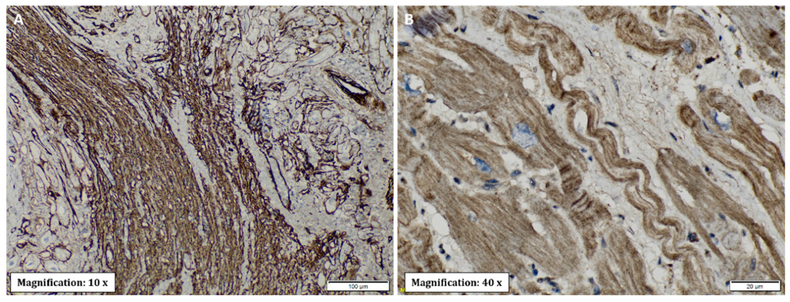 Pathogens 11 01402 g006