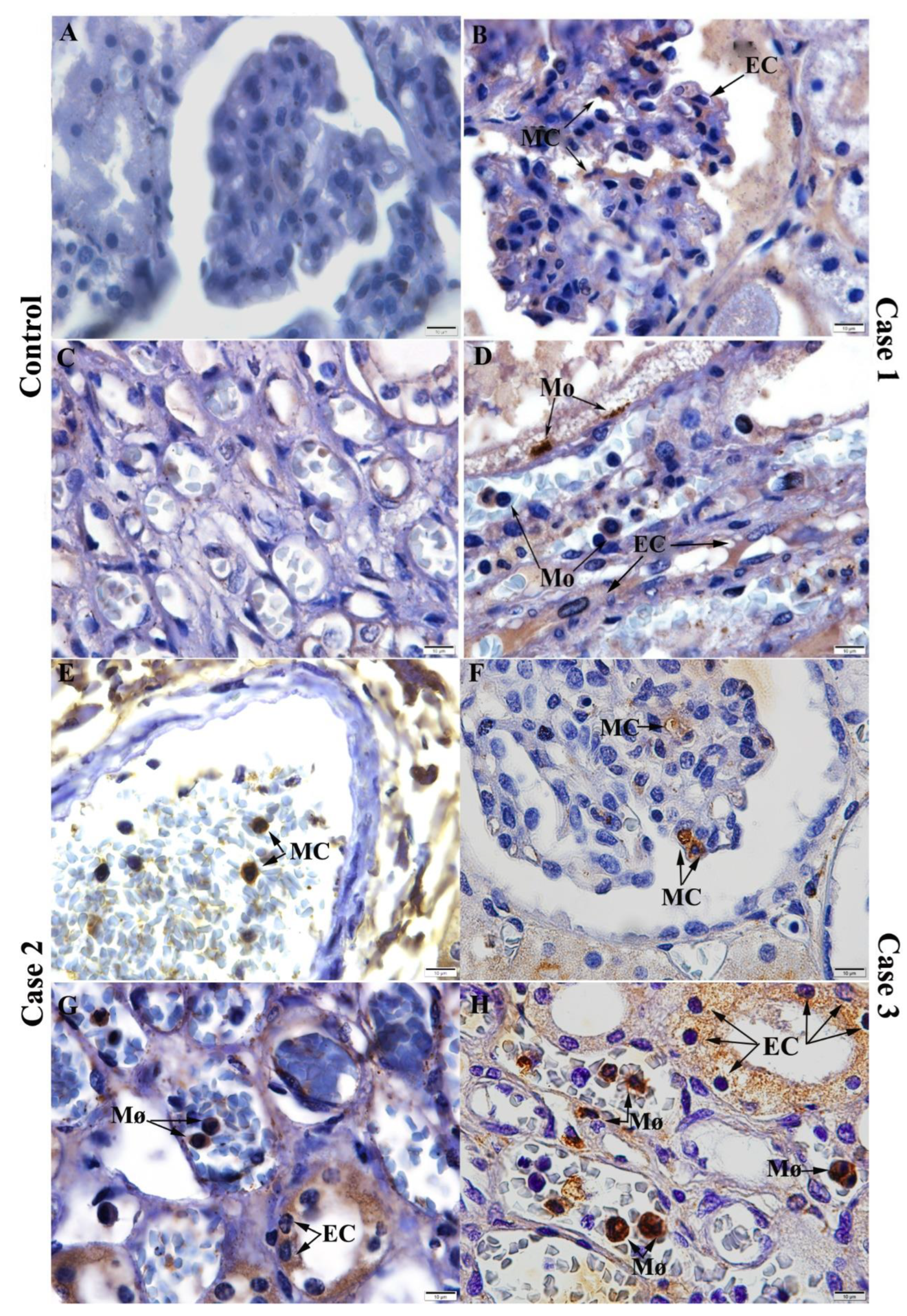 Pathogens 11 01543 g004 Pathogens 11 01543 g004