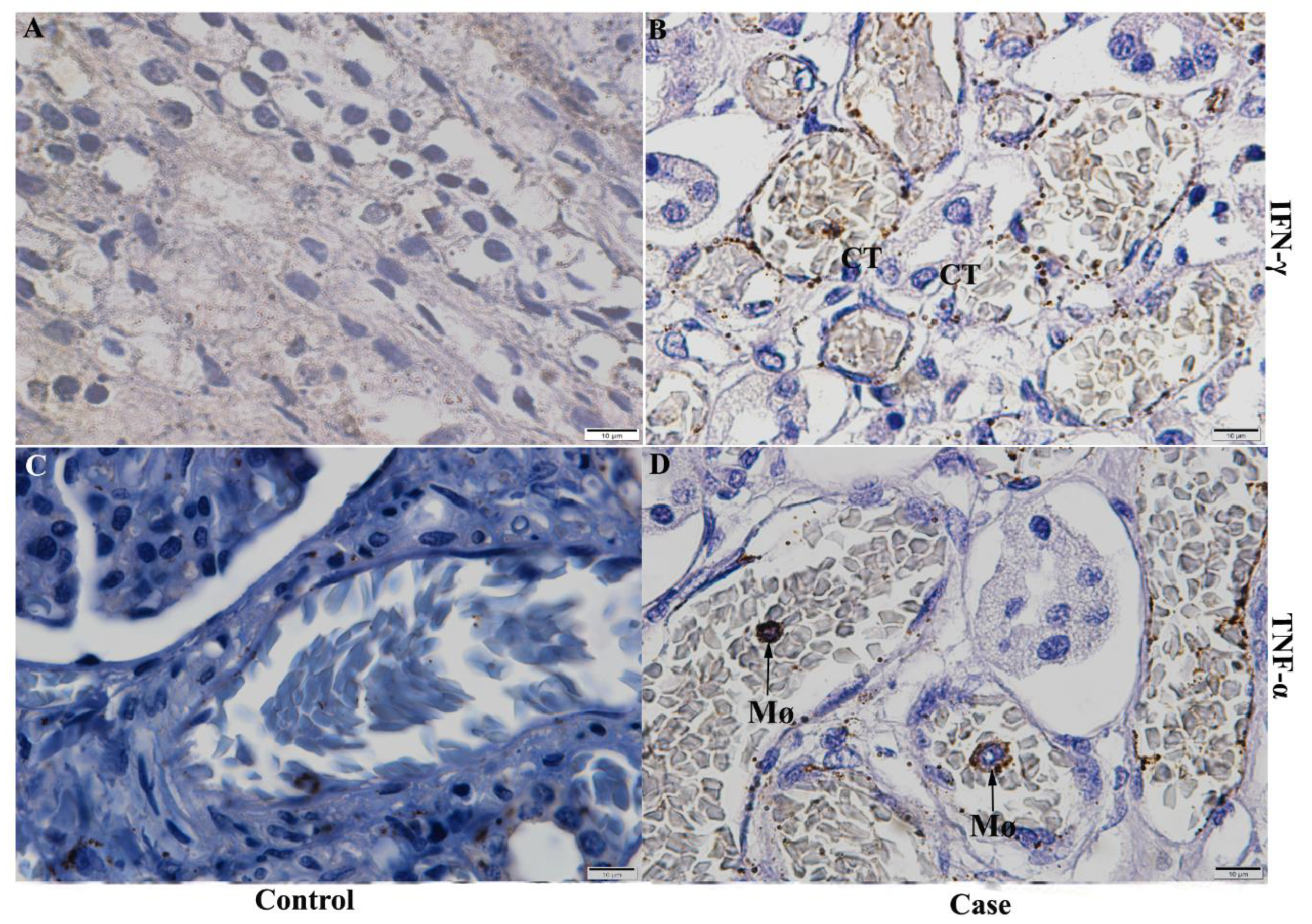 Pathogens 11 01543 g006 Pathogens 11 01543 g006