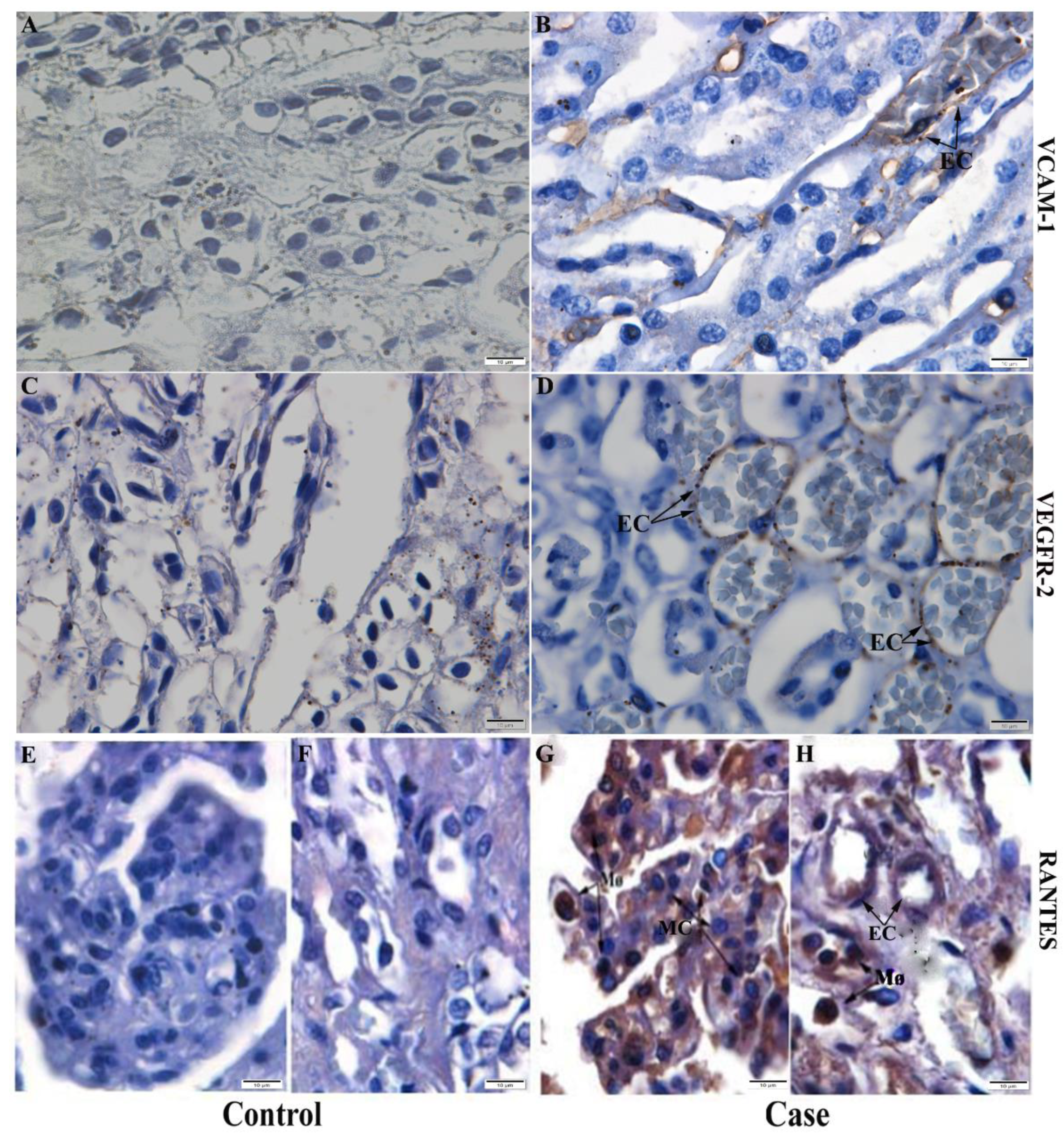 Pathogens 11 01543 g007 Pathogens 11 01543 g007