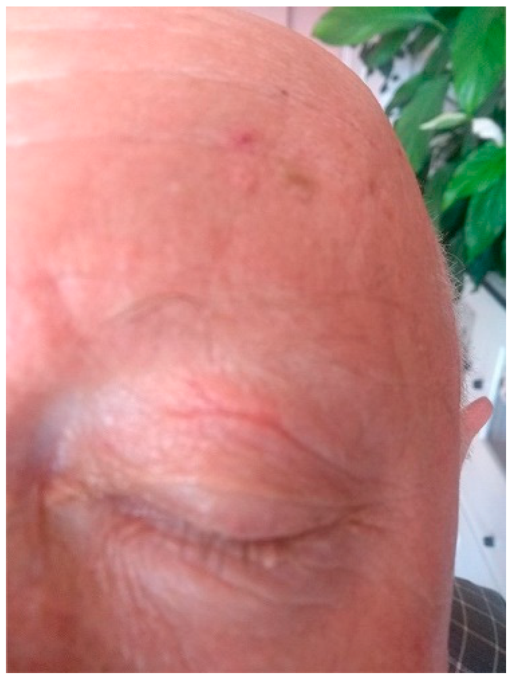 Pathogens 12 00196 g003