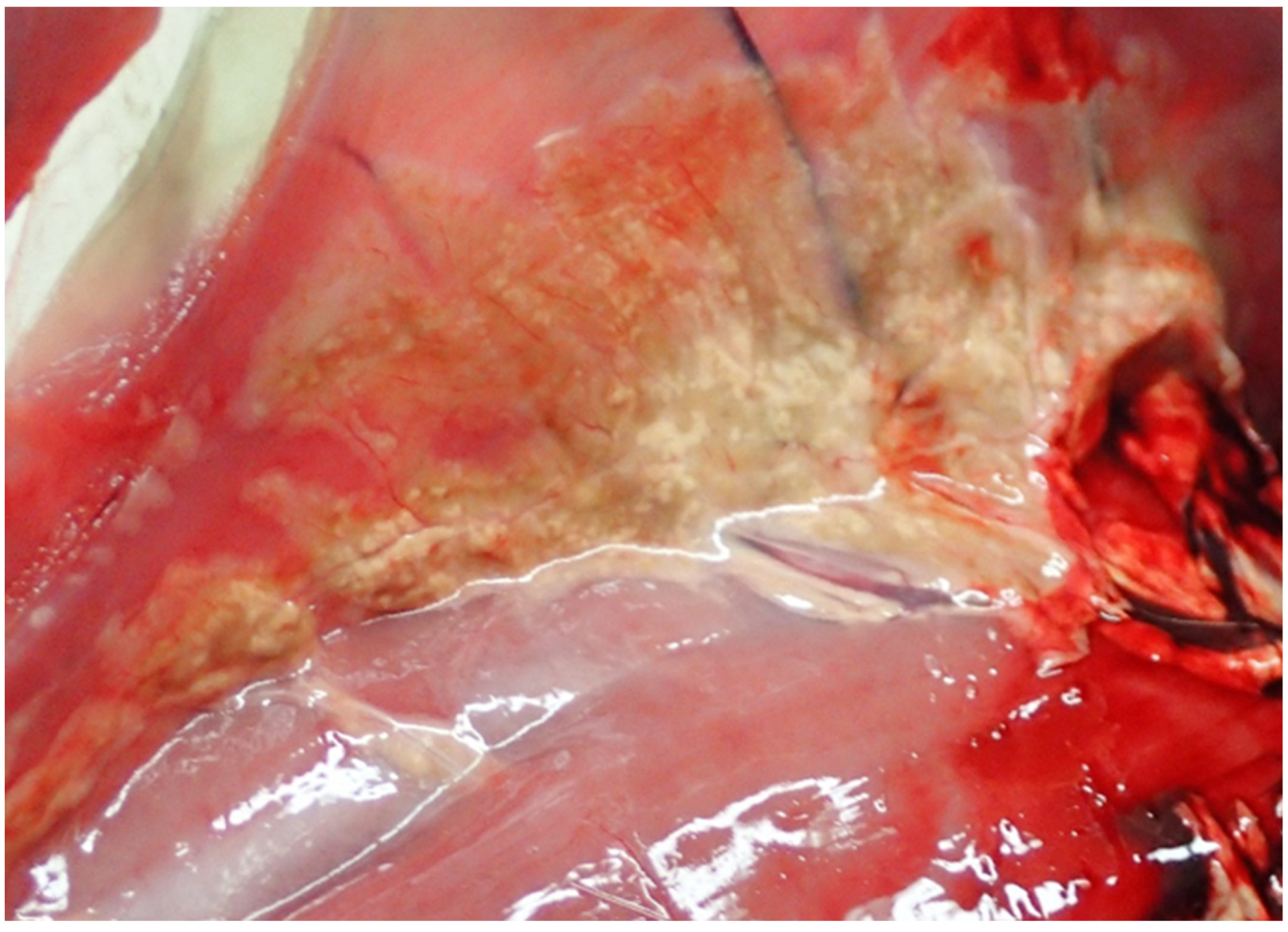 Pathogens 12 00239 g004