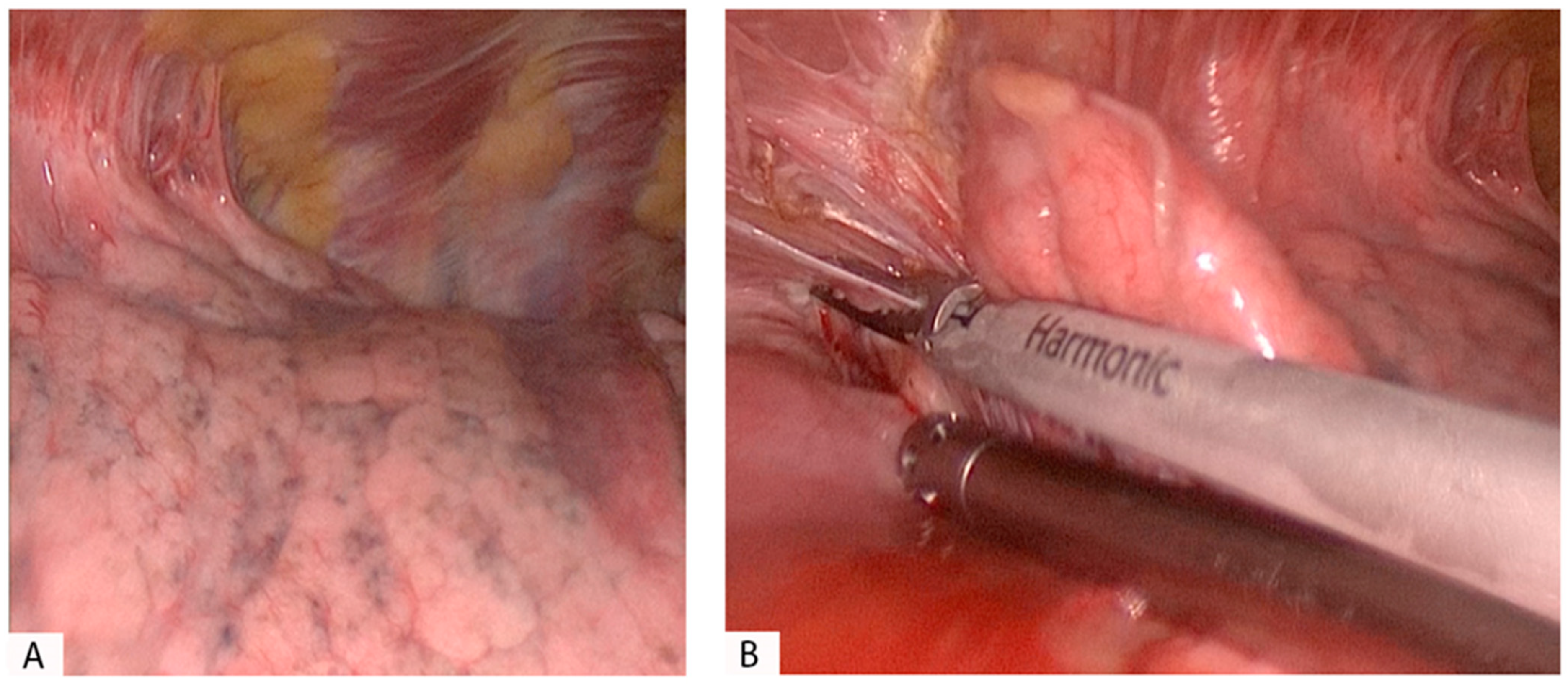 Pathogens 12 00257 g002