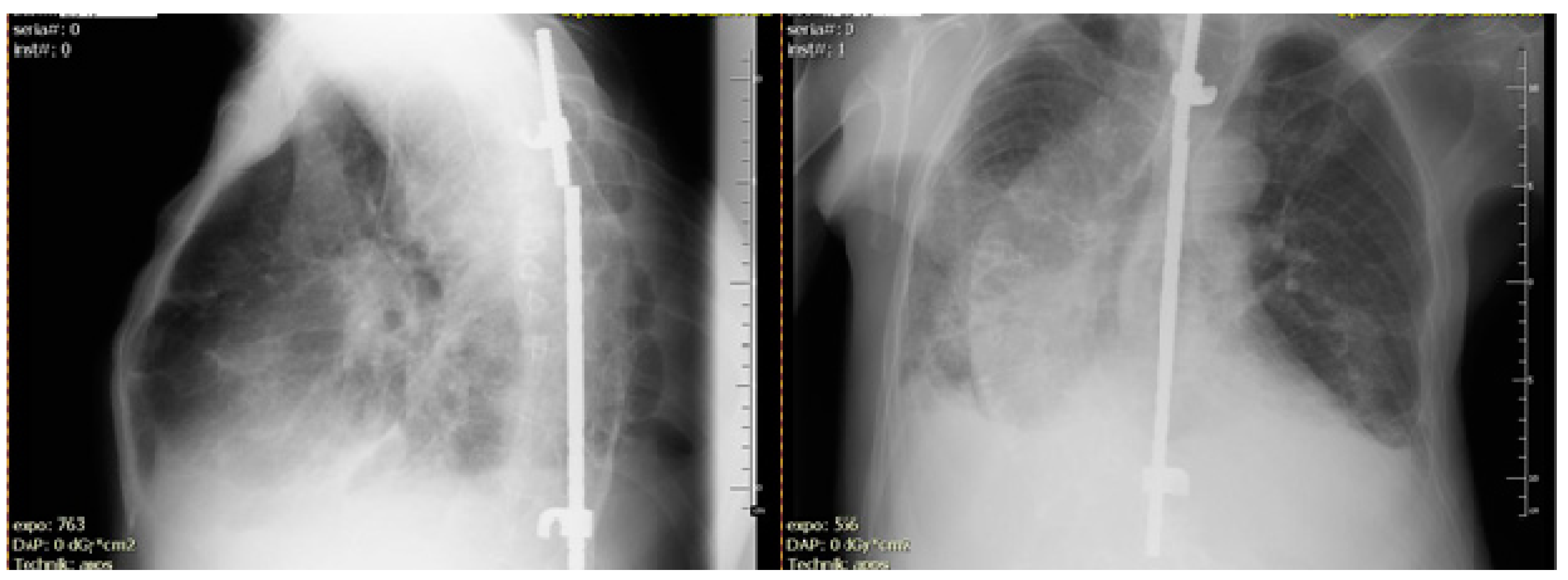Pathogens 12 00331 g001 Pathogens 12 00331 g001