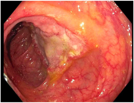 Pathogens 12 00694 g002