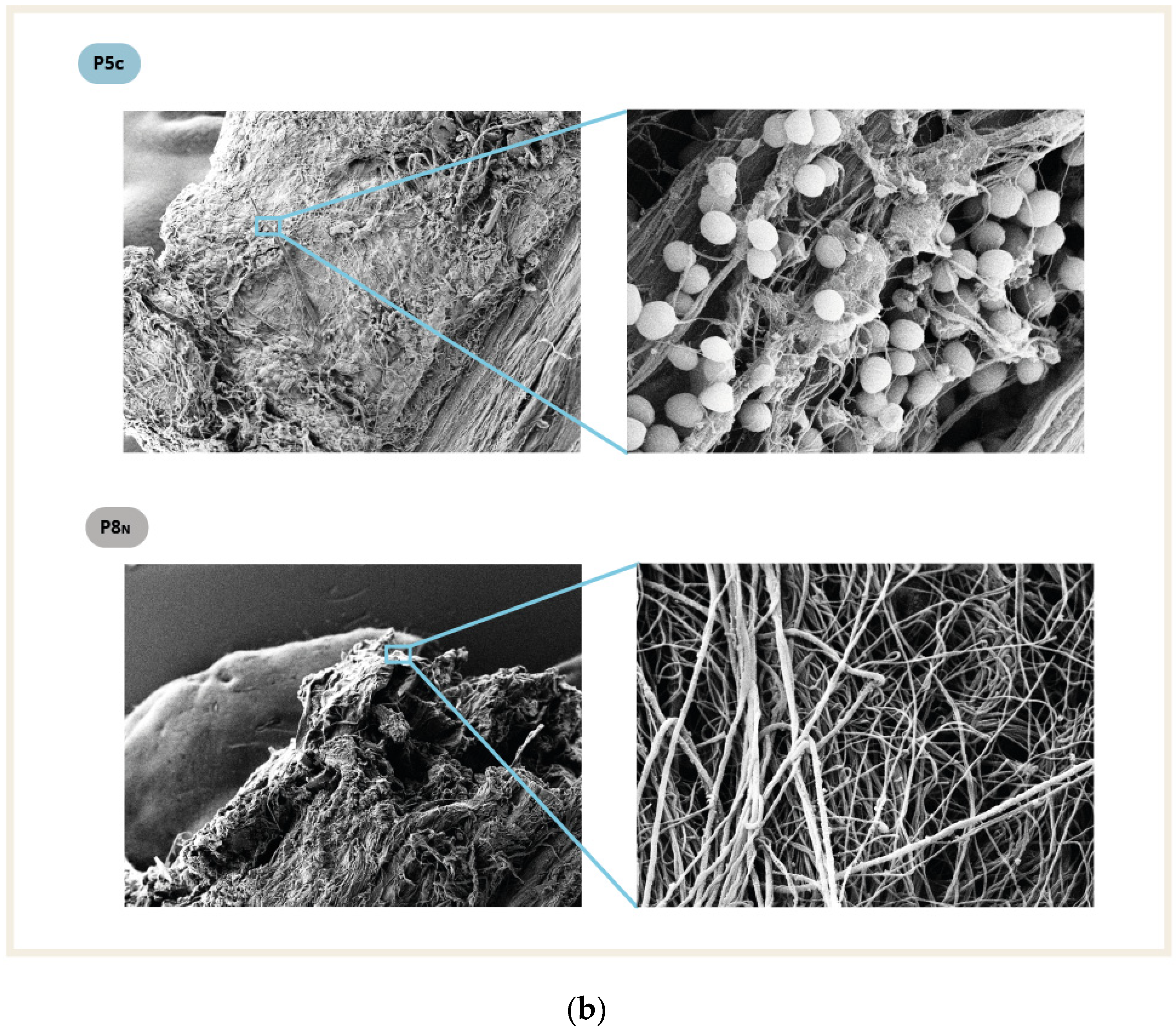 Pathogens 12 00761 g004b