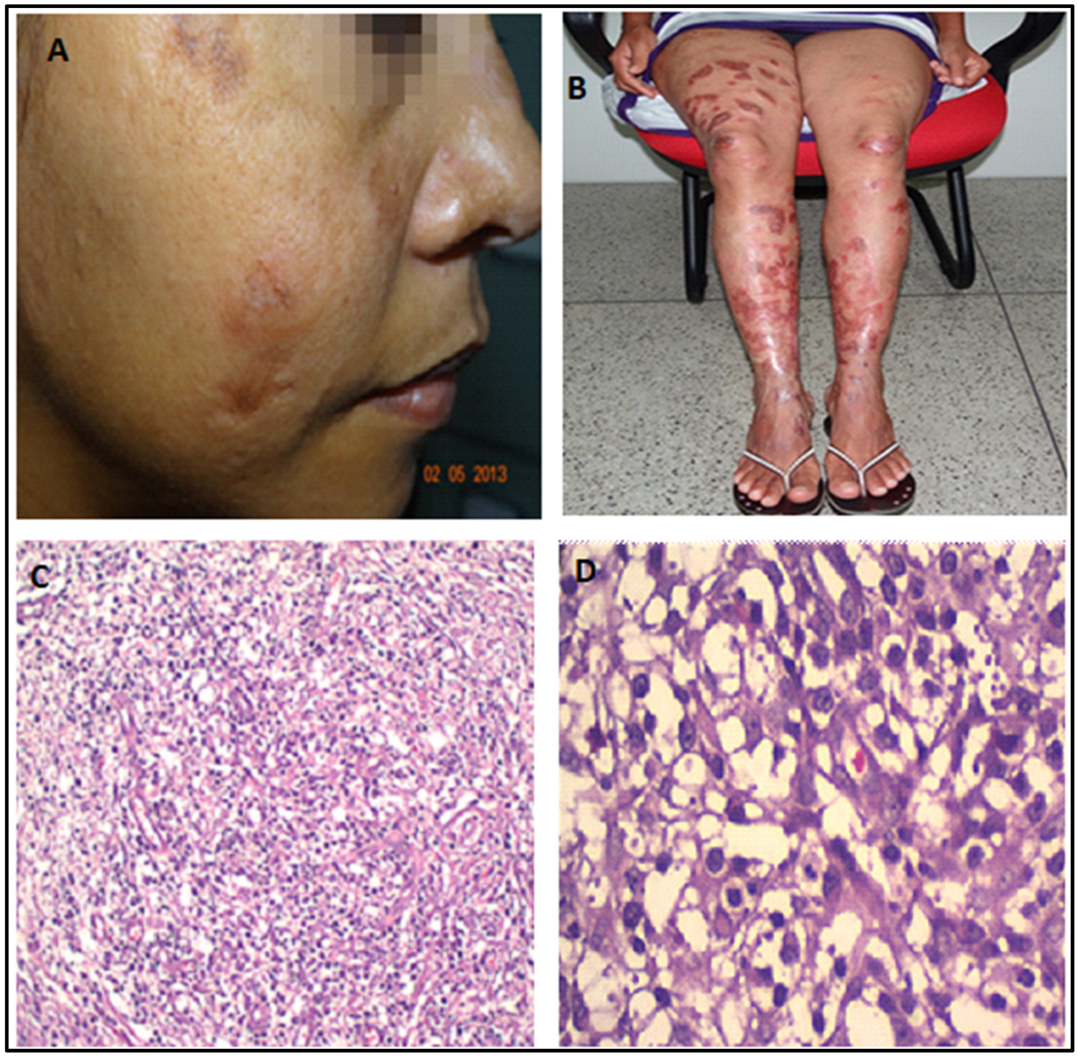 Pathogens 12 00890 g003 Pathogens 12 00890 g003