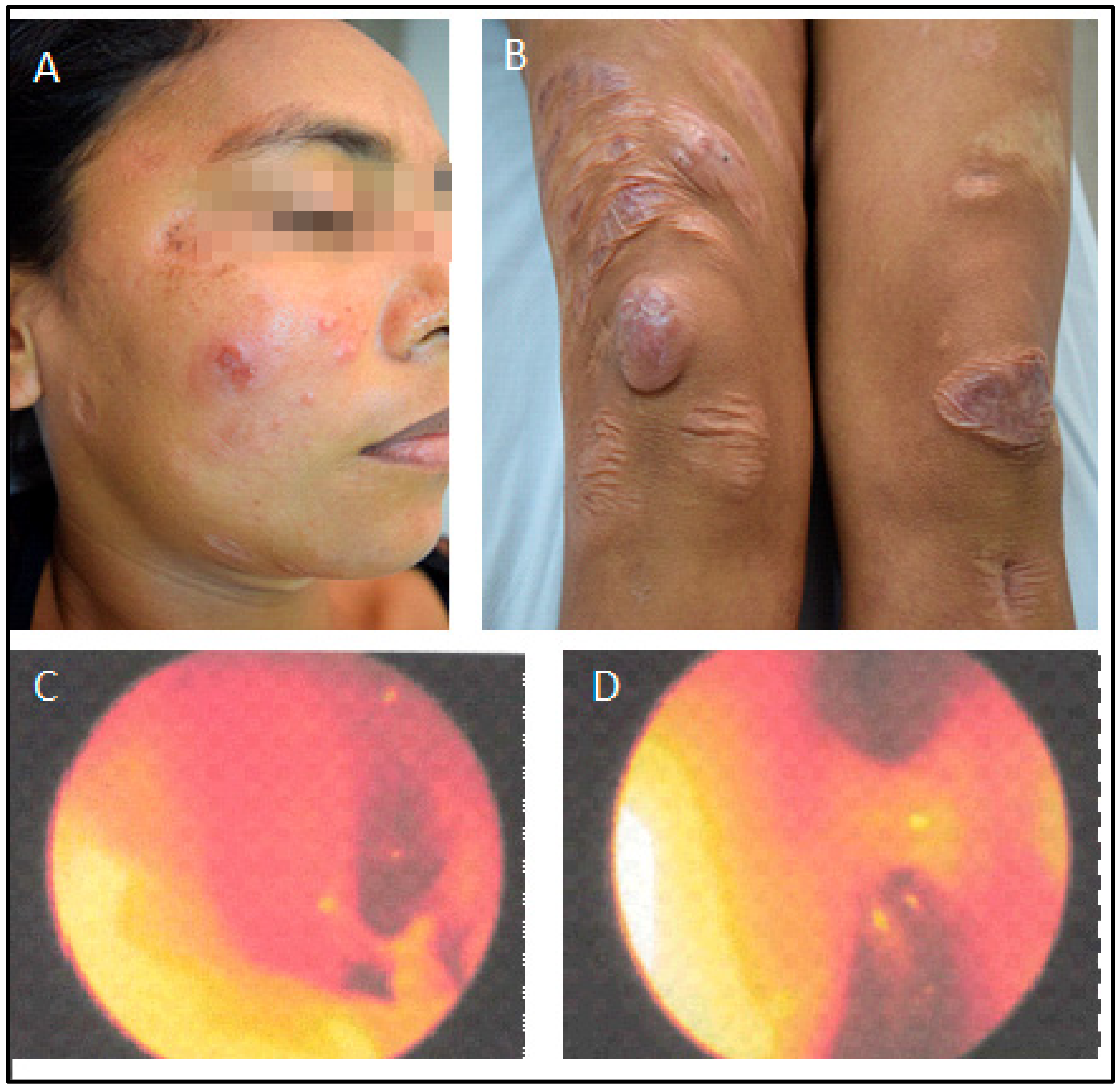 Pathogens 12 00890 g004 Pathogens 12 00890 g004
