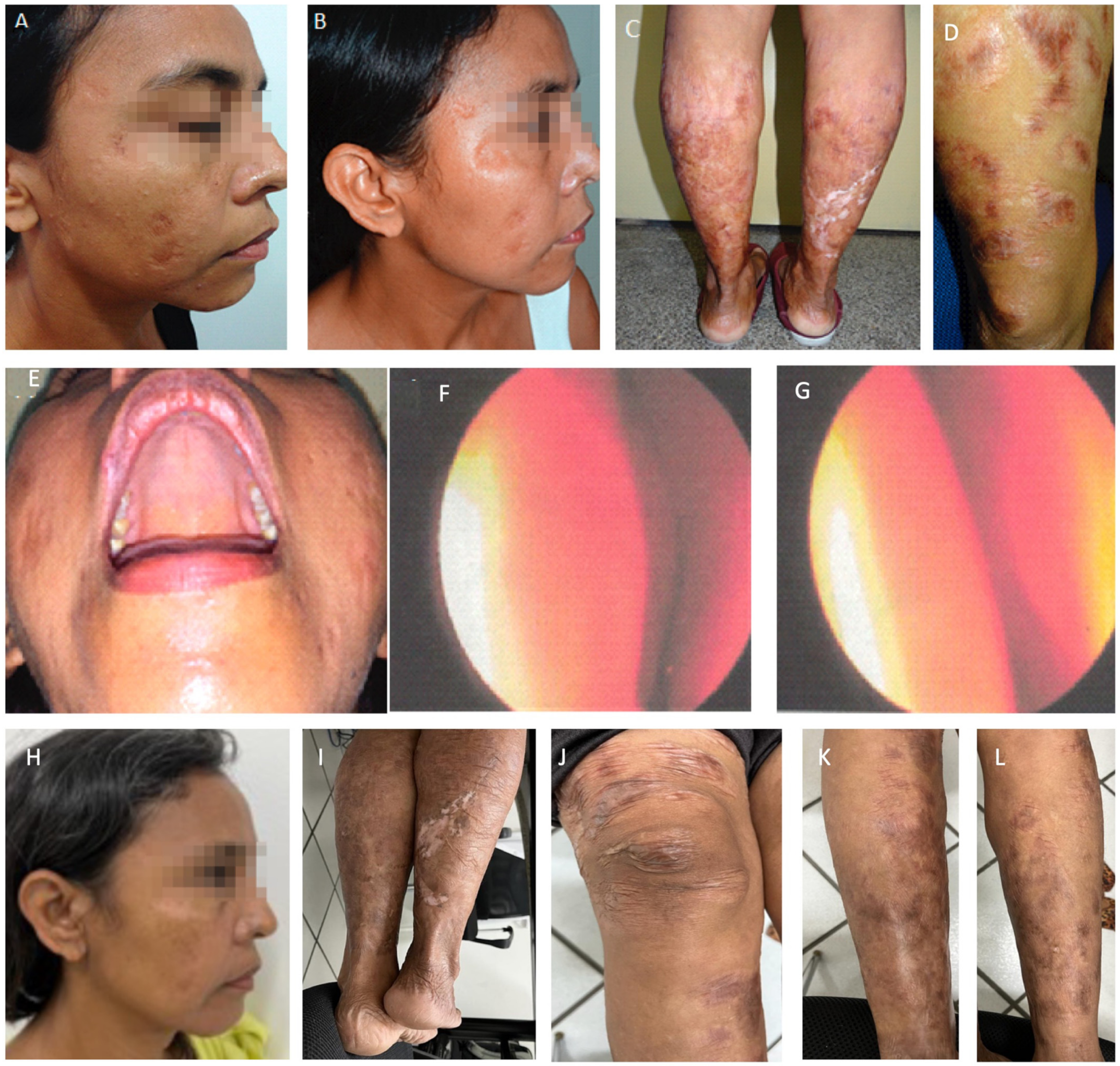 Pathogens 12 00890 g005 Pathogens 12 00890 g005