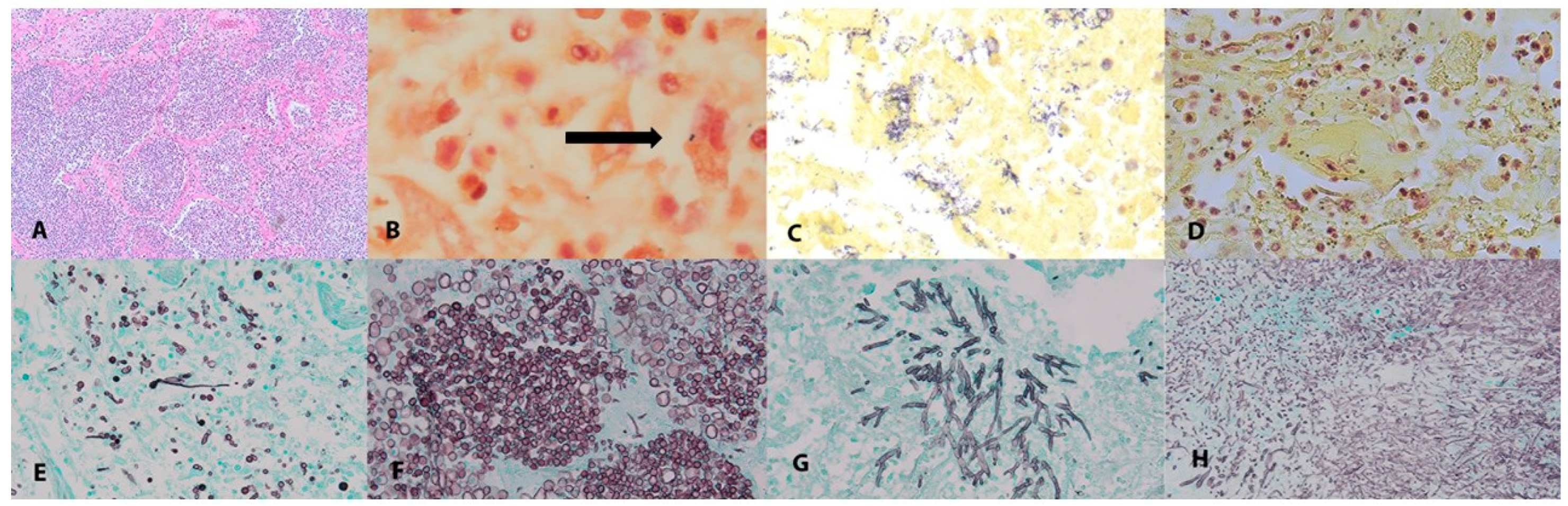 Pathogens 12 00932 g001