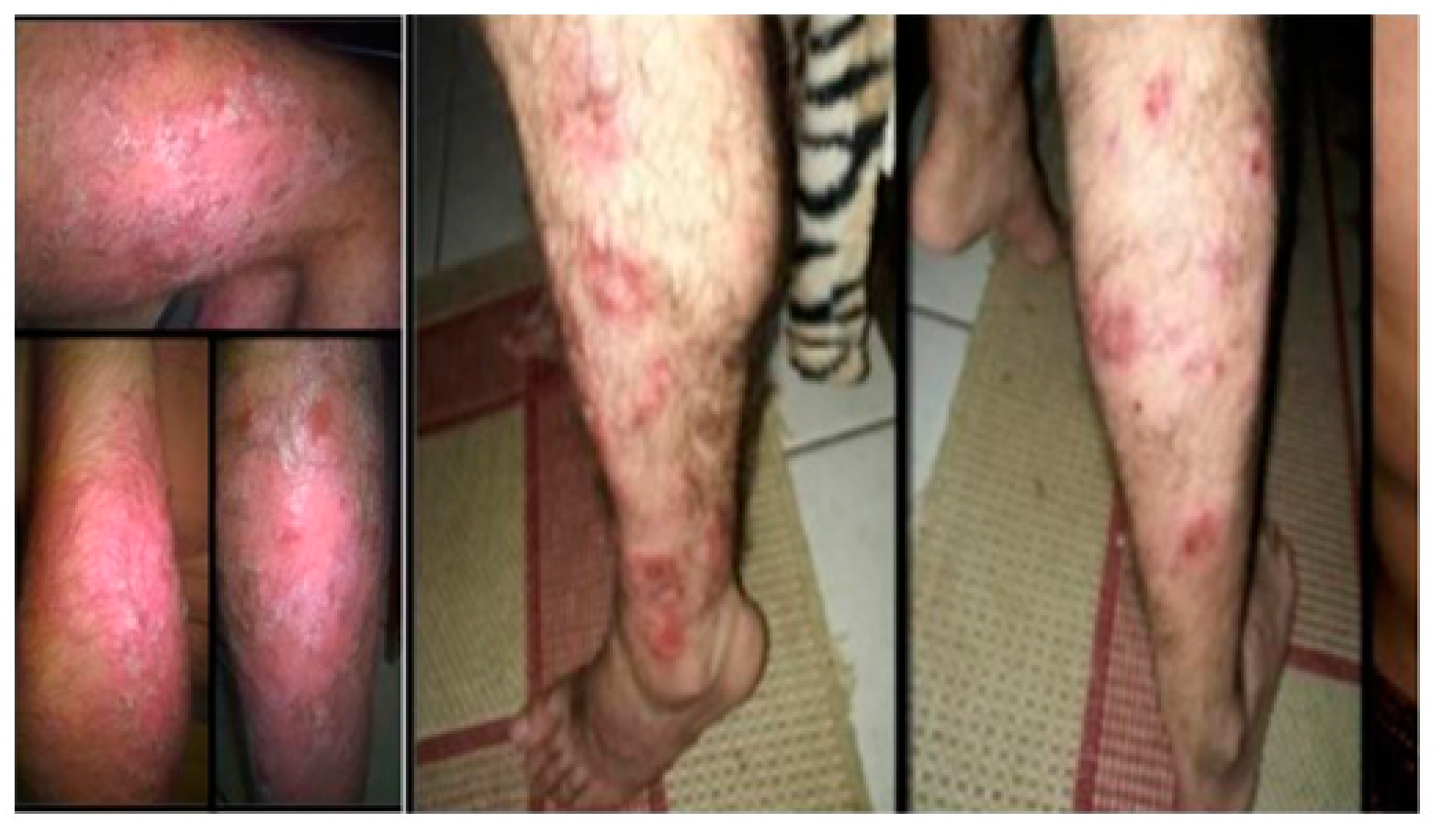 Pathogens 12 01156 g001