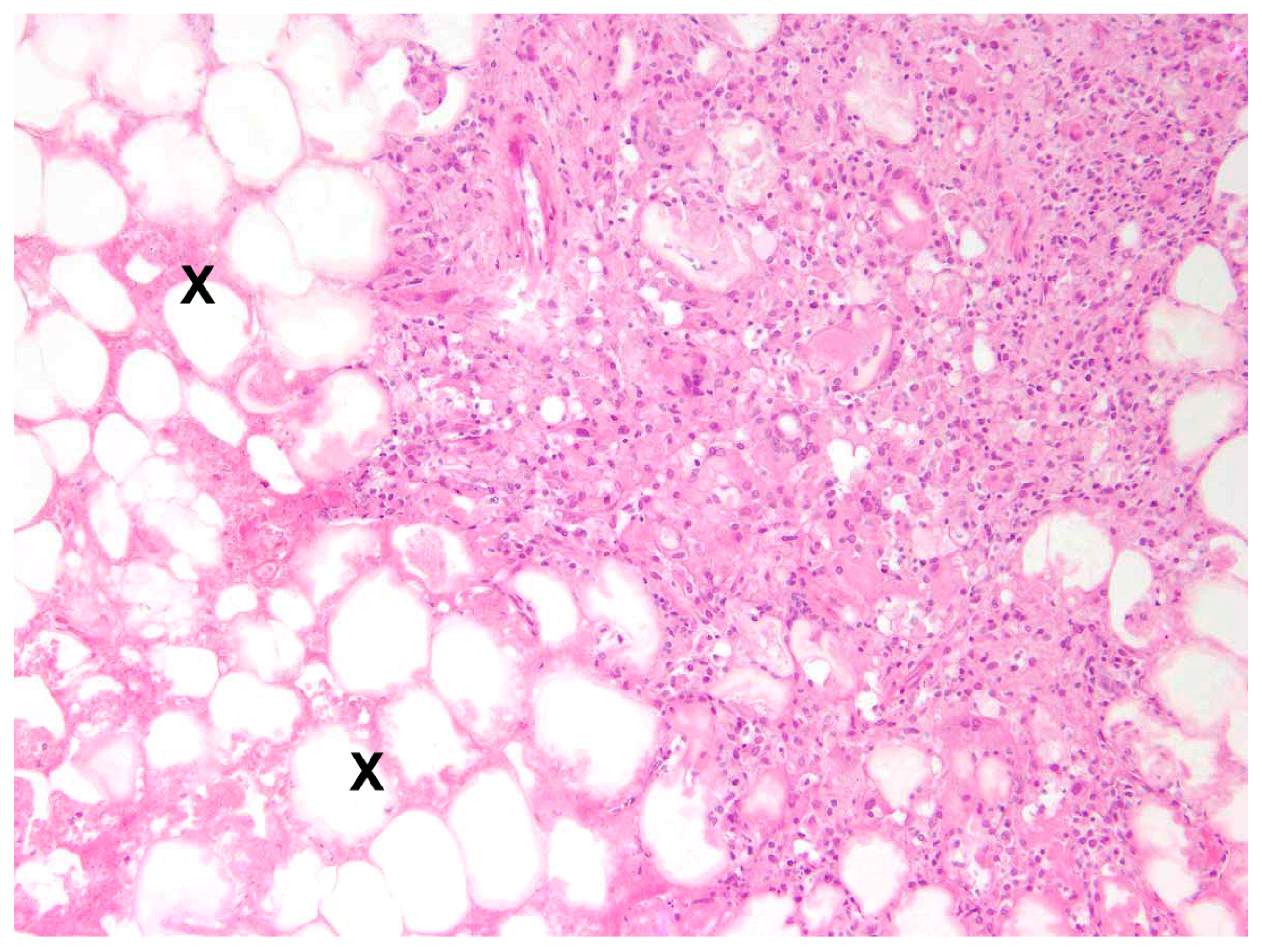 Pathogens 12 01317 g009