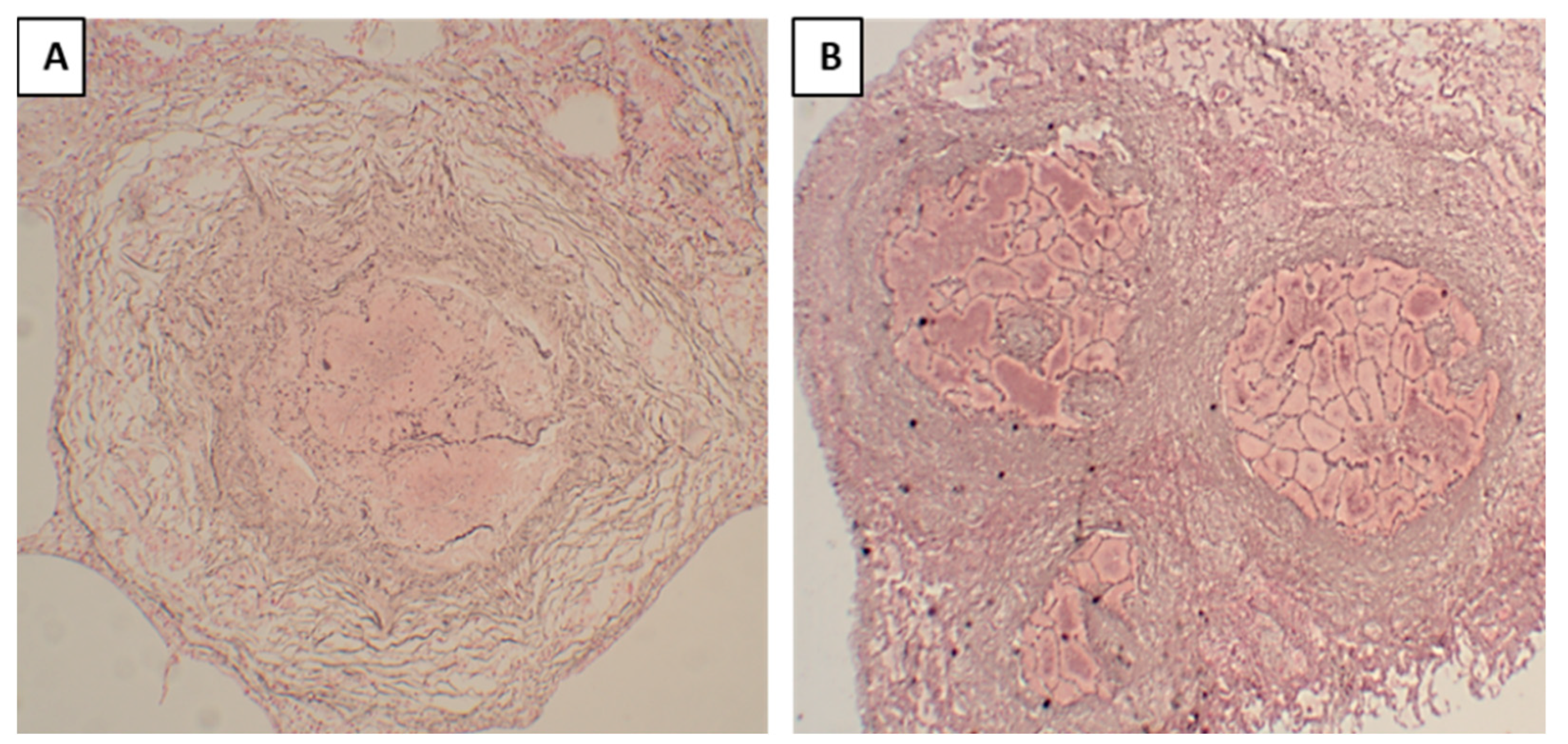 Pathogens 12 01426 g004