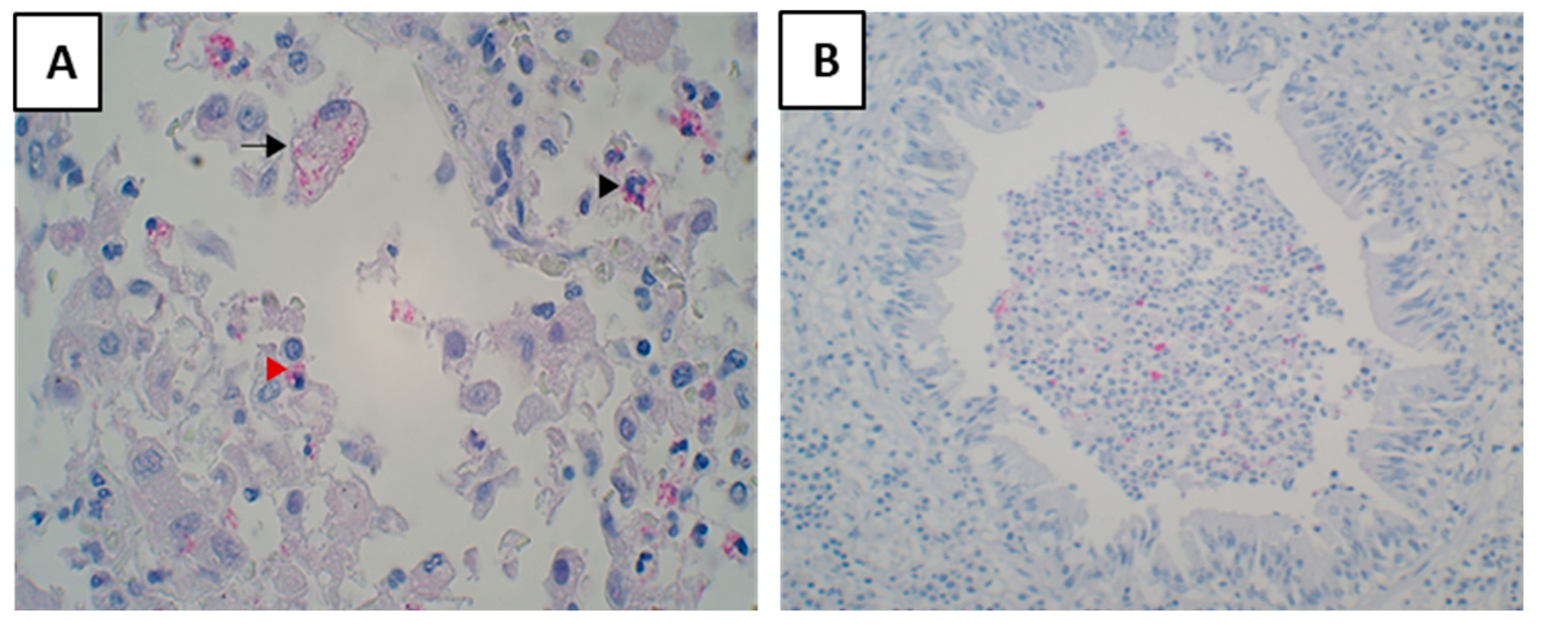 Pathogens 12 01426 g006
