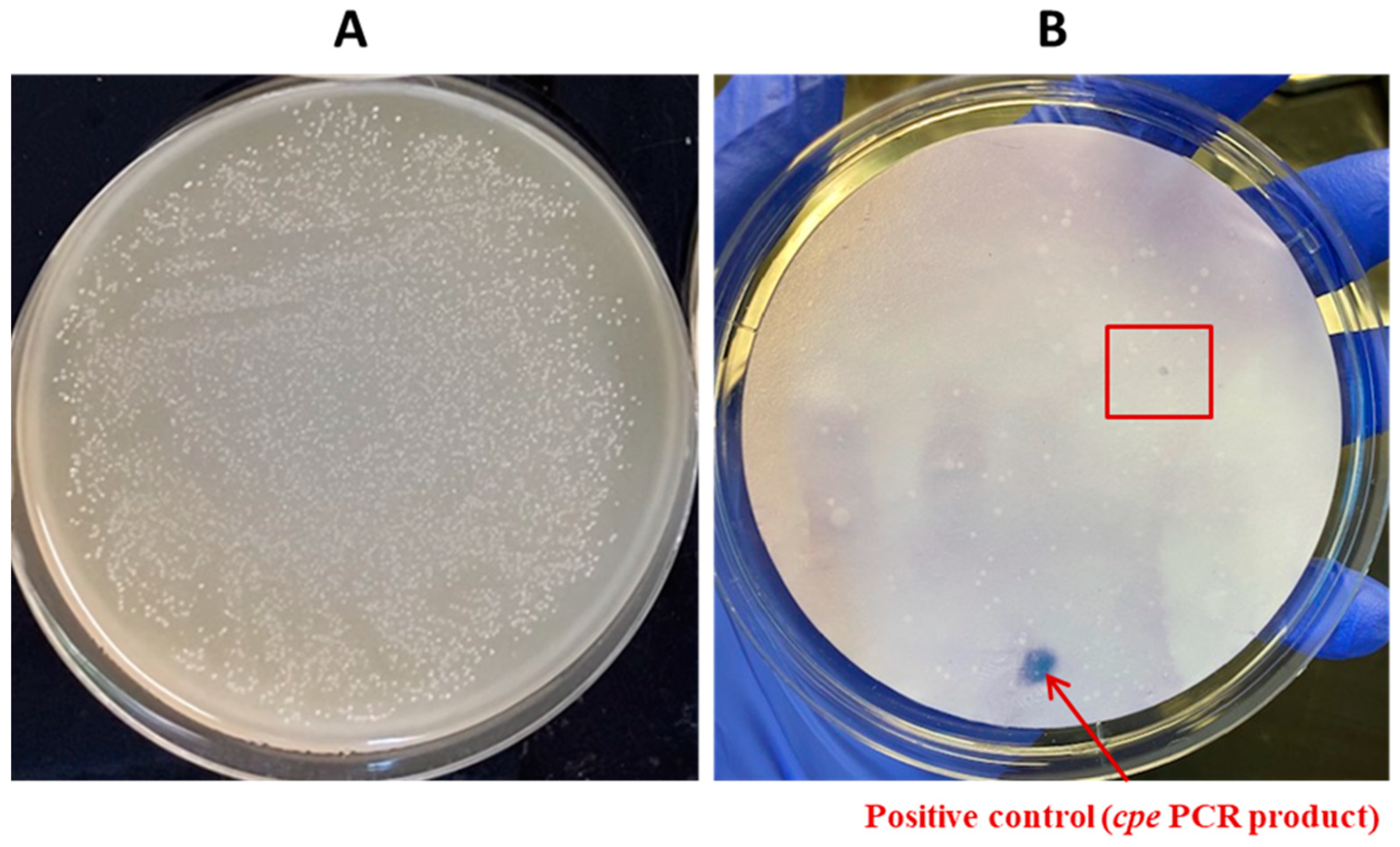Pathogens 13 00030 g011