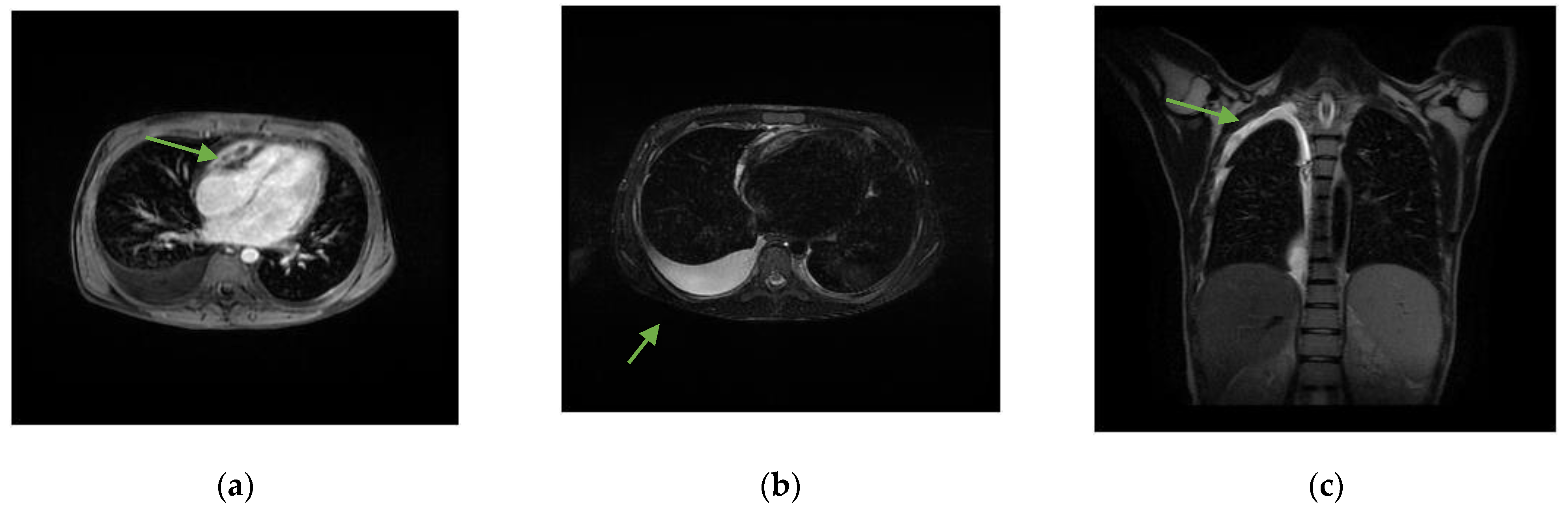 Pathogens 13 00110 g001
