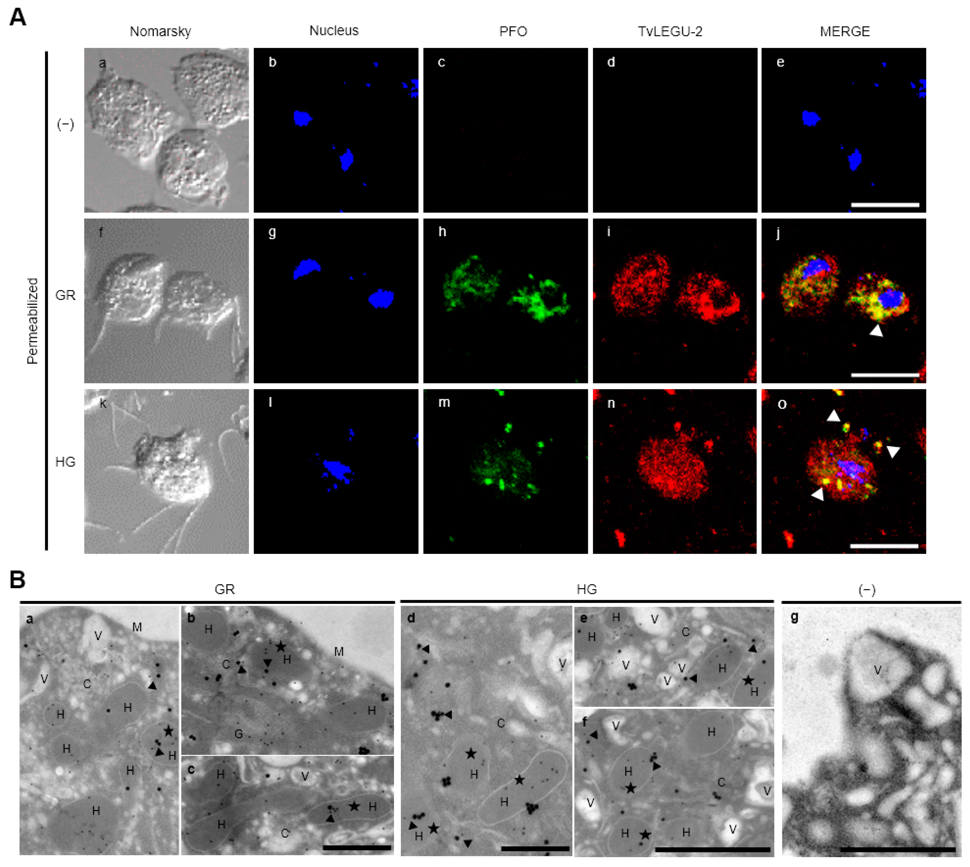 Pathogens 13 00119 g004