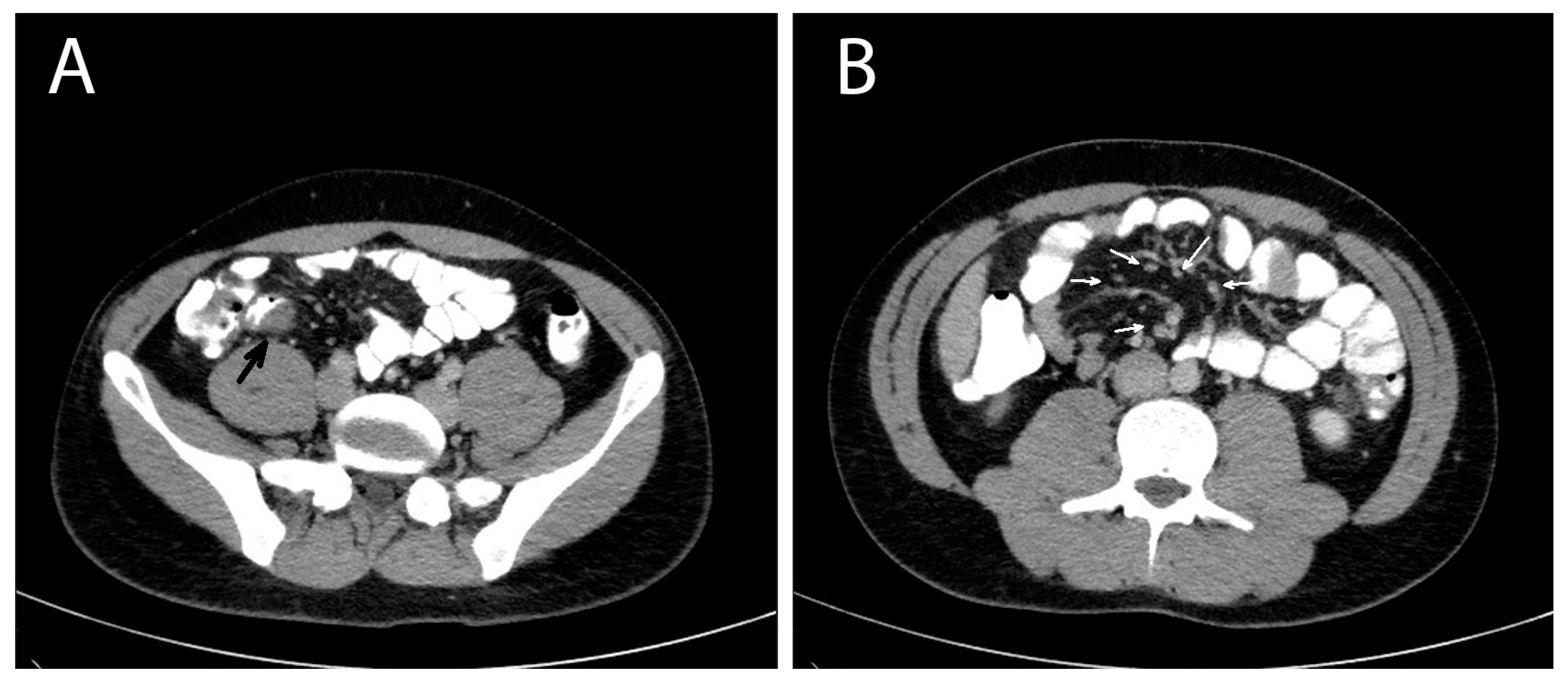 Pathogens 13 00149 g001