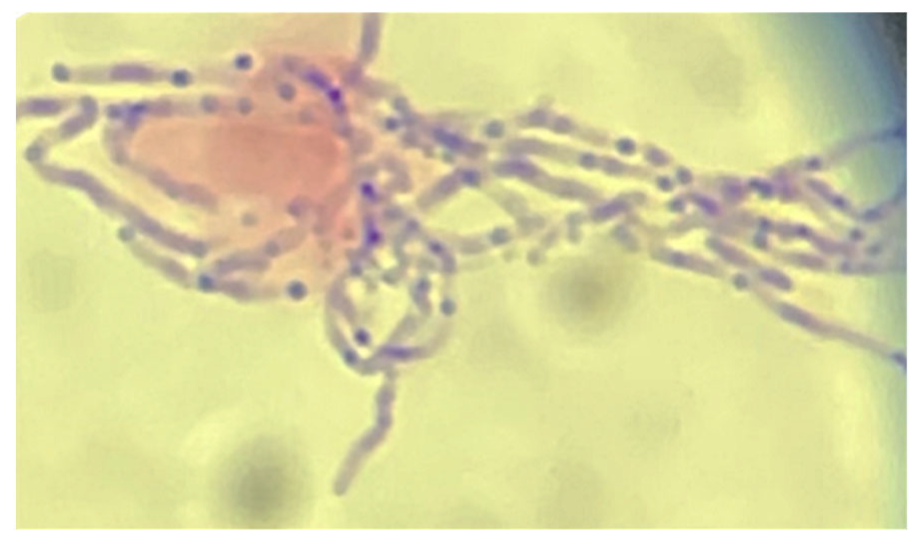 Pathogens 13 00165 g004
