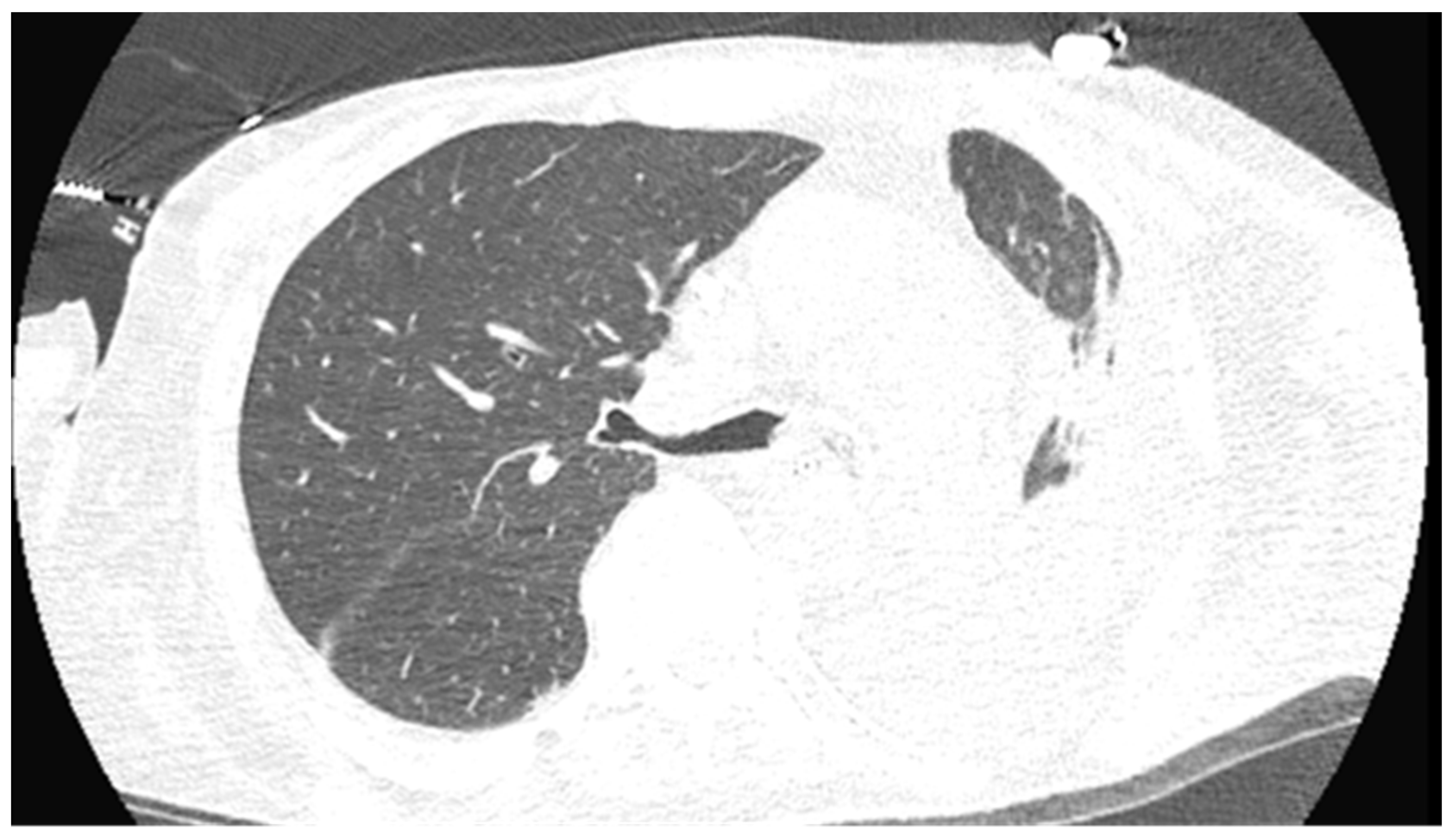 Pathogens 13 00165 g005