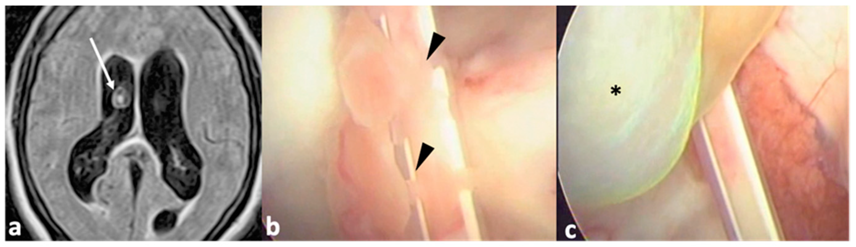 Pathogens 13 00218 g001