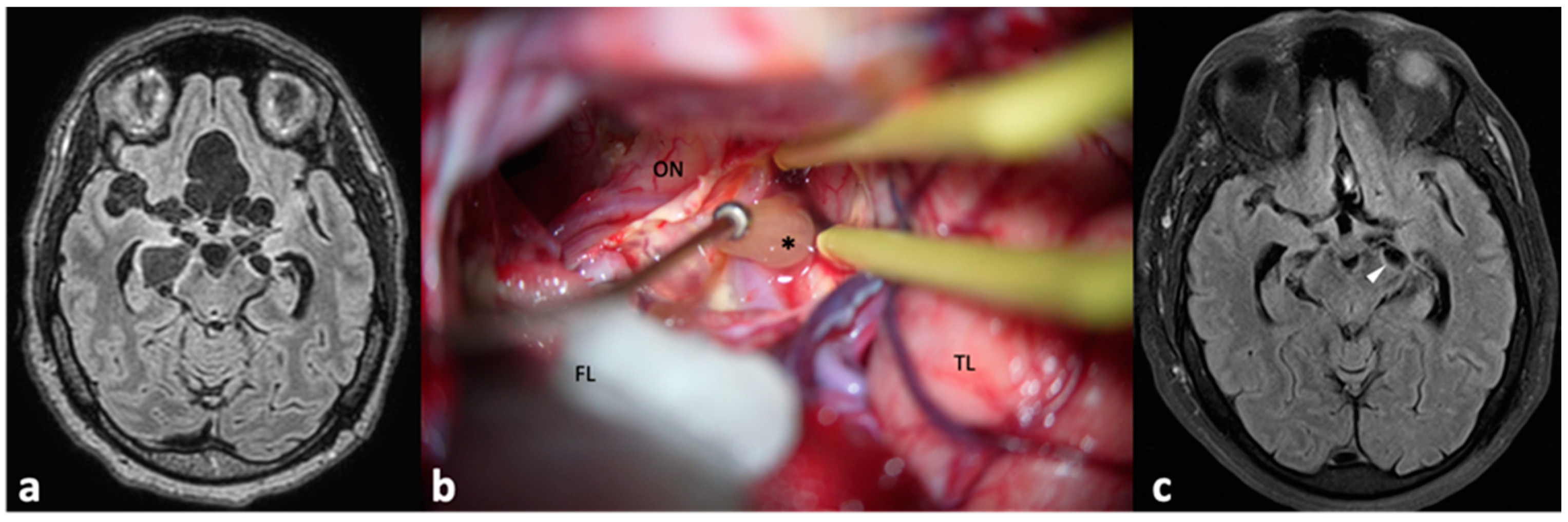 Pathogens 13 00218 g005