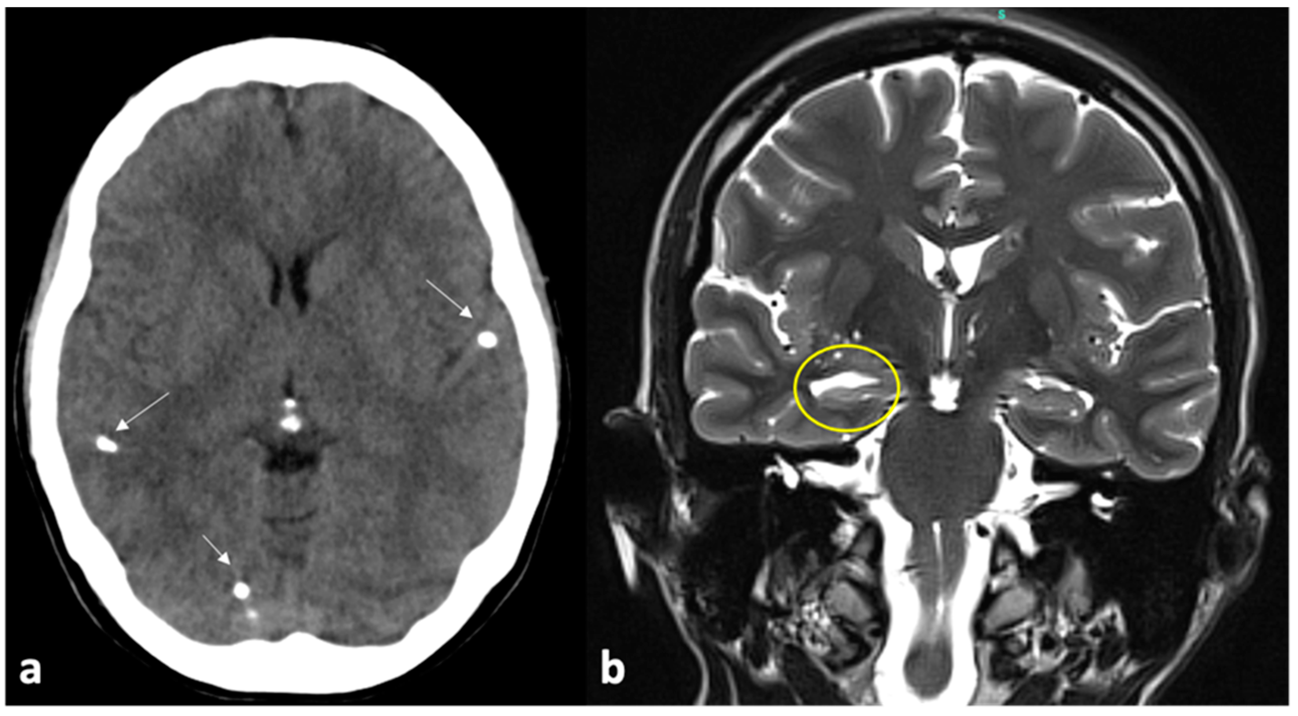 Pathogens 13 00218 g007