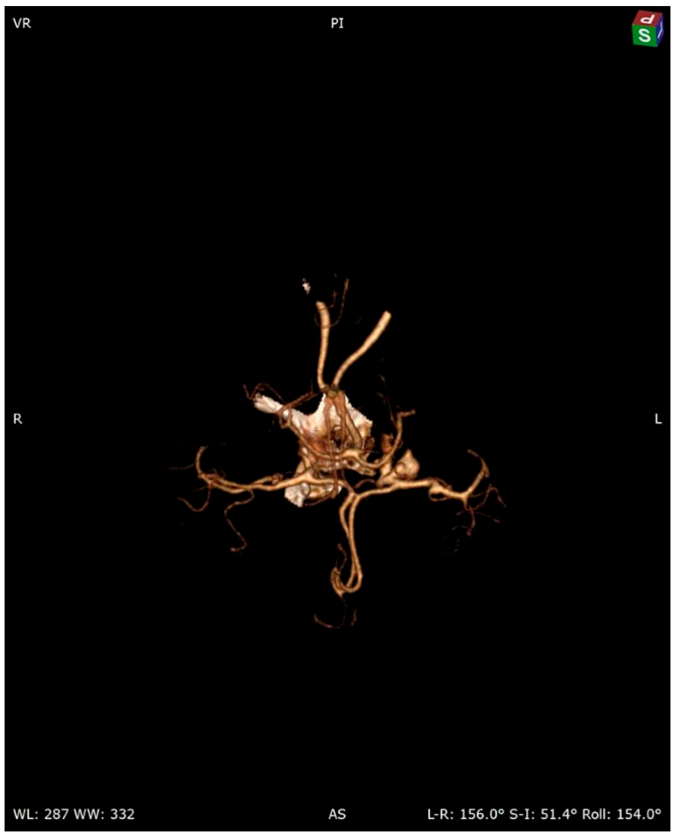 Pathogens 13 00254 g001