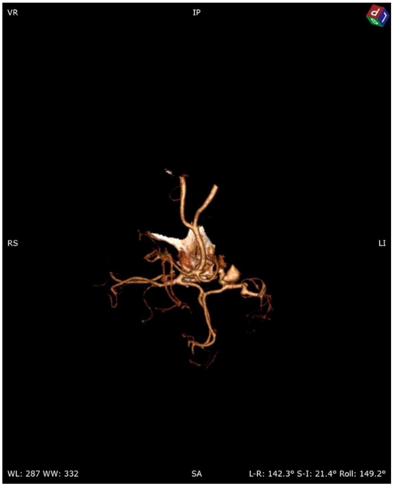 Pathogens 13 00254 g002