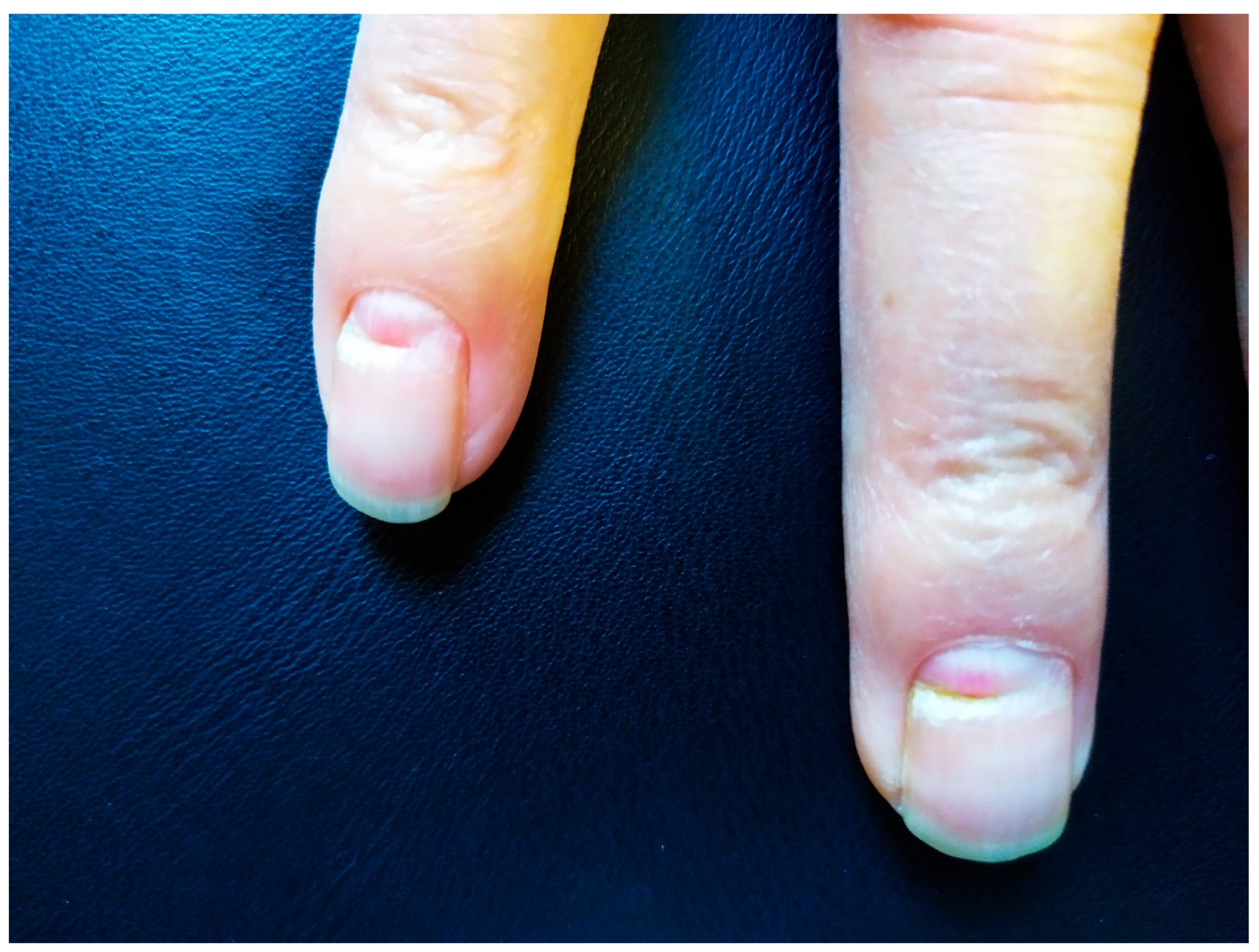 Pathogens 13 00265 g002