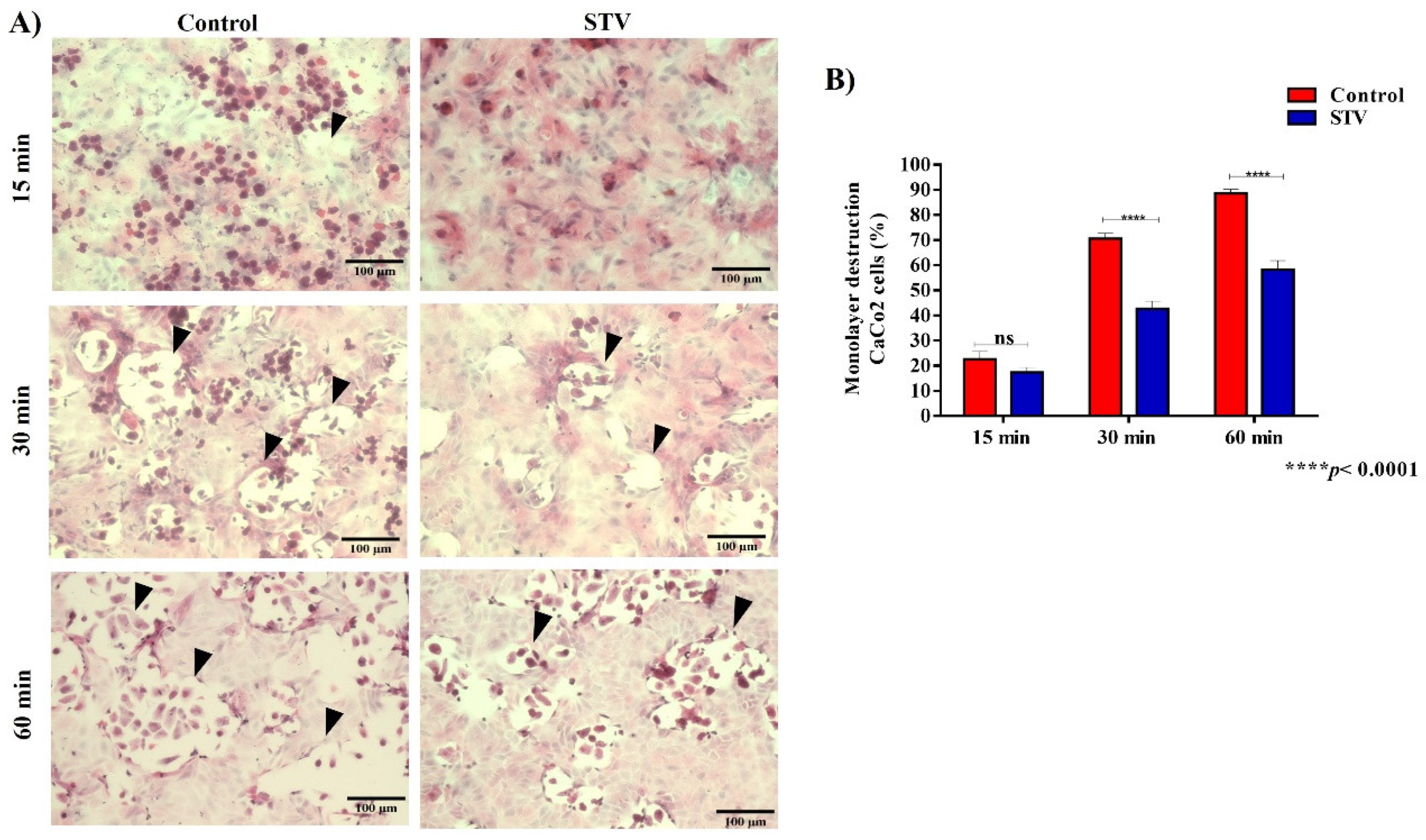Pathogens 13 00373 g005