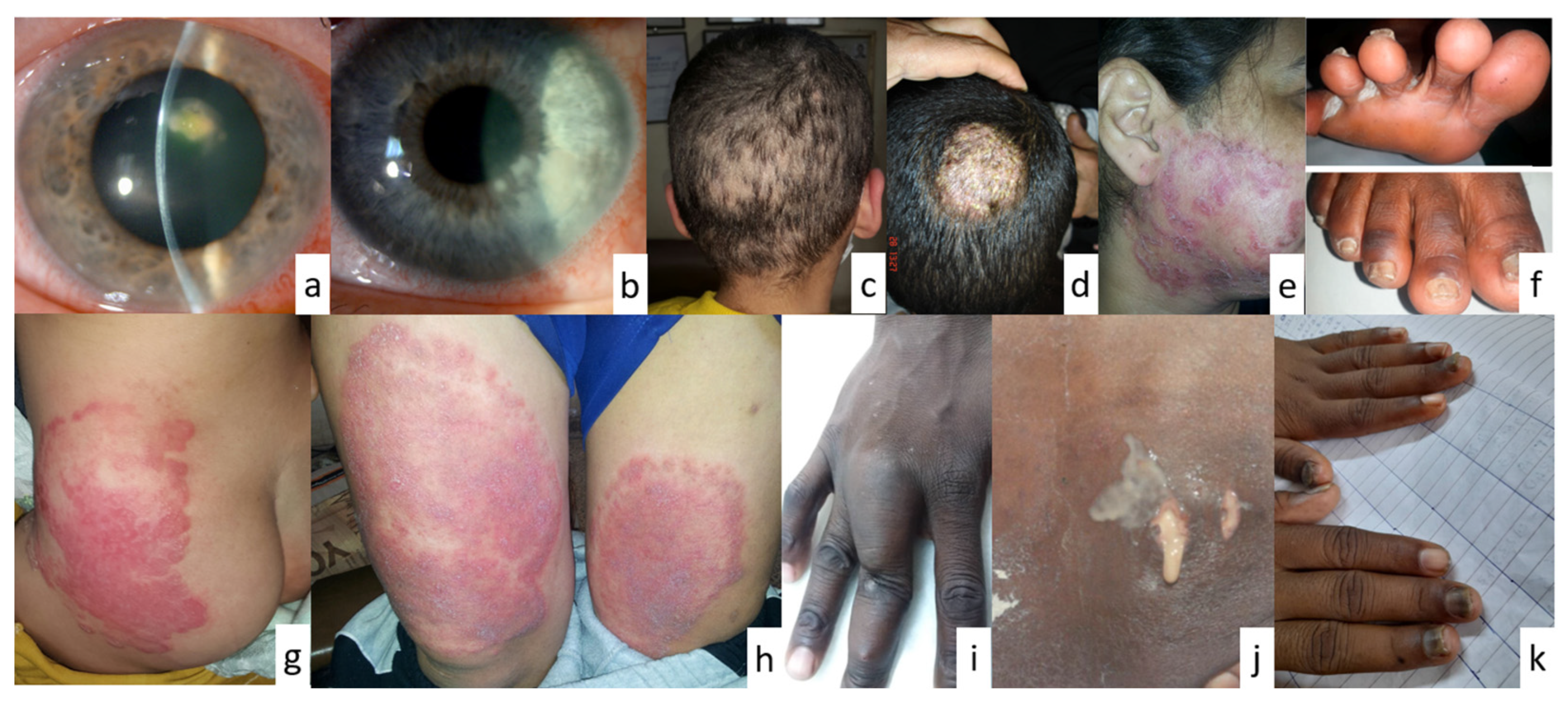 Pathogens 13 00426 g004