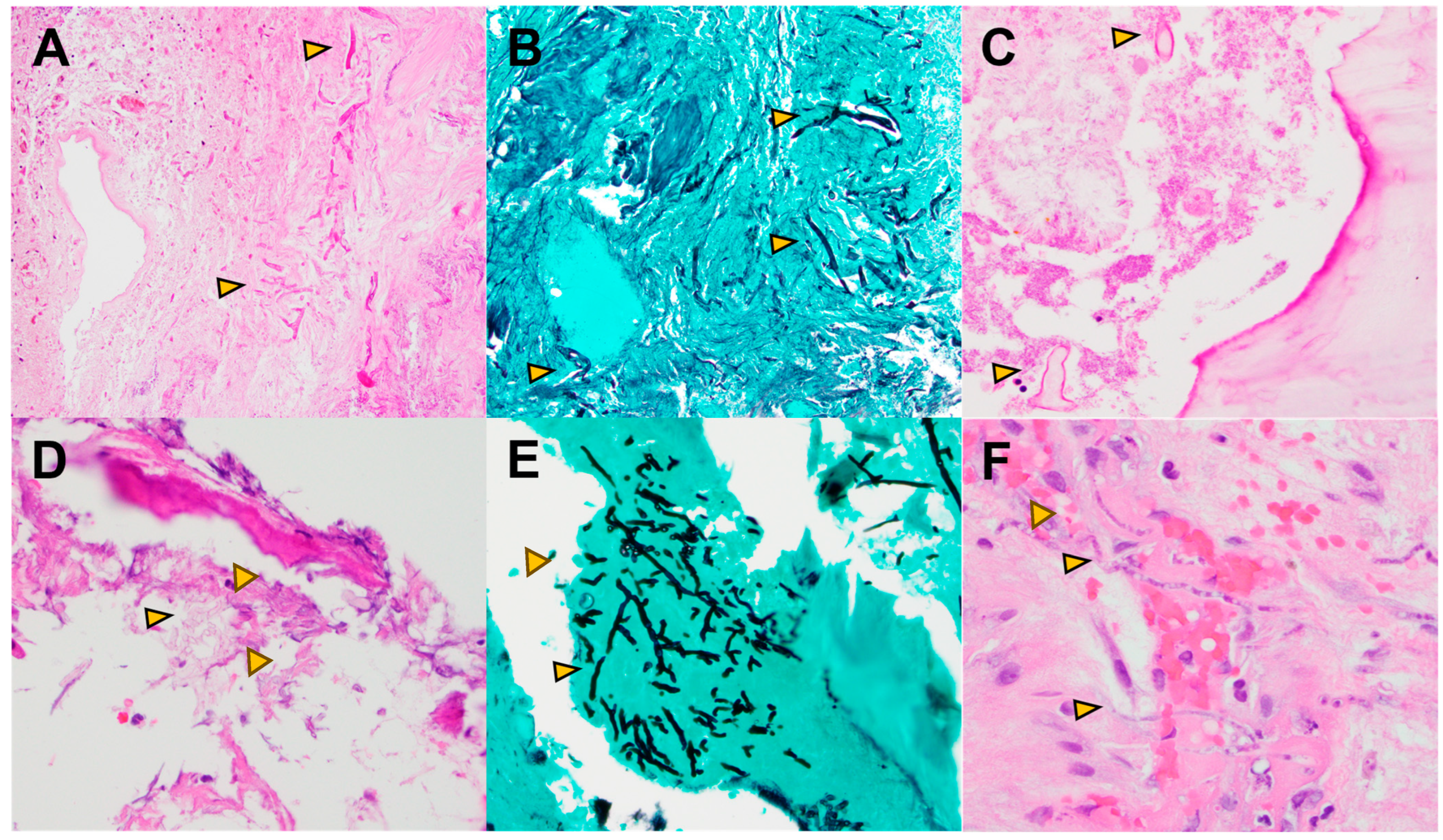 Pathogens 13 00530 g001