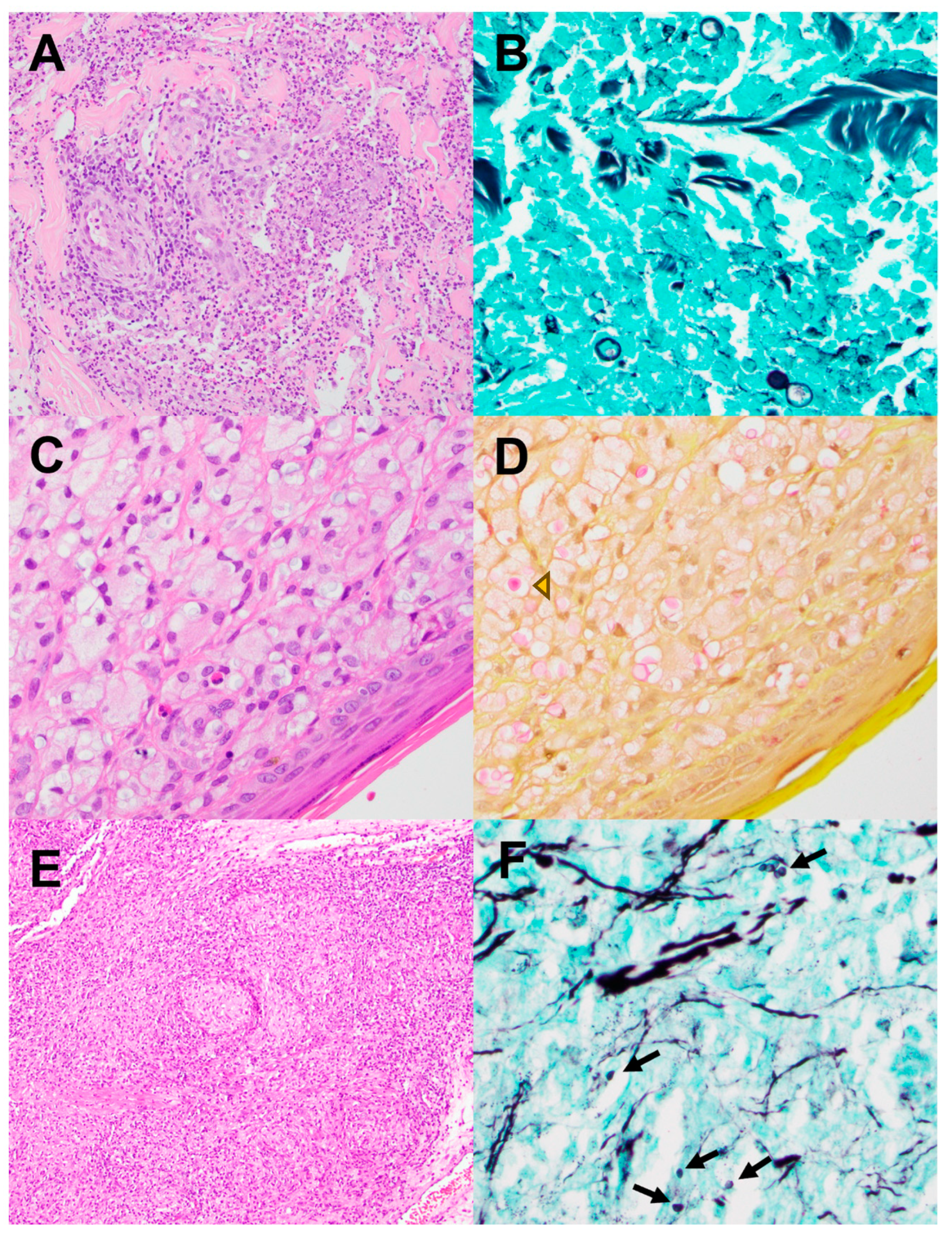 Pathogens 13 00530 g004