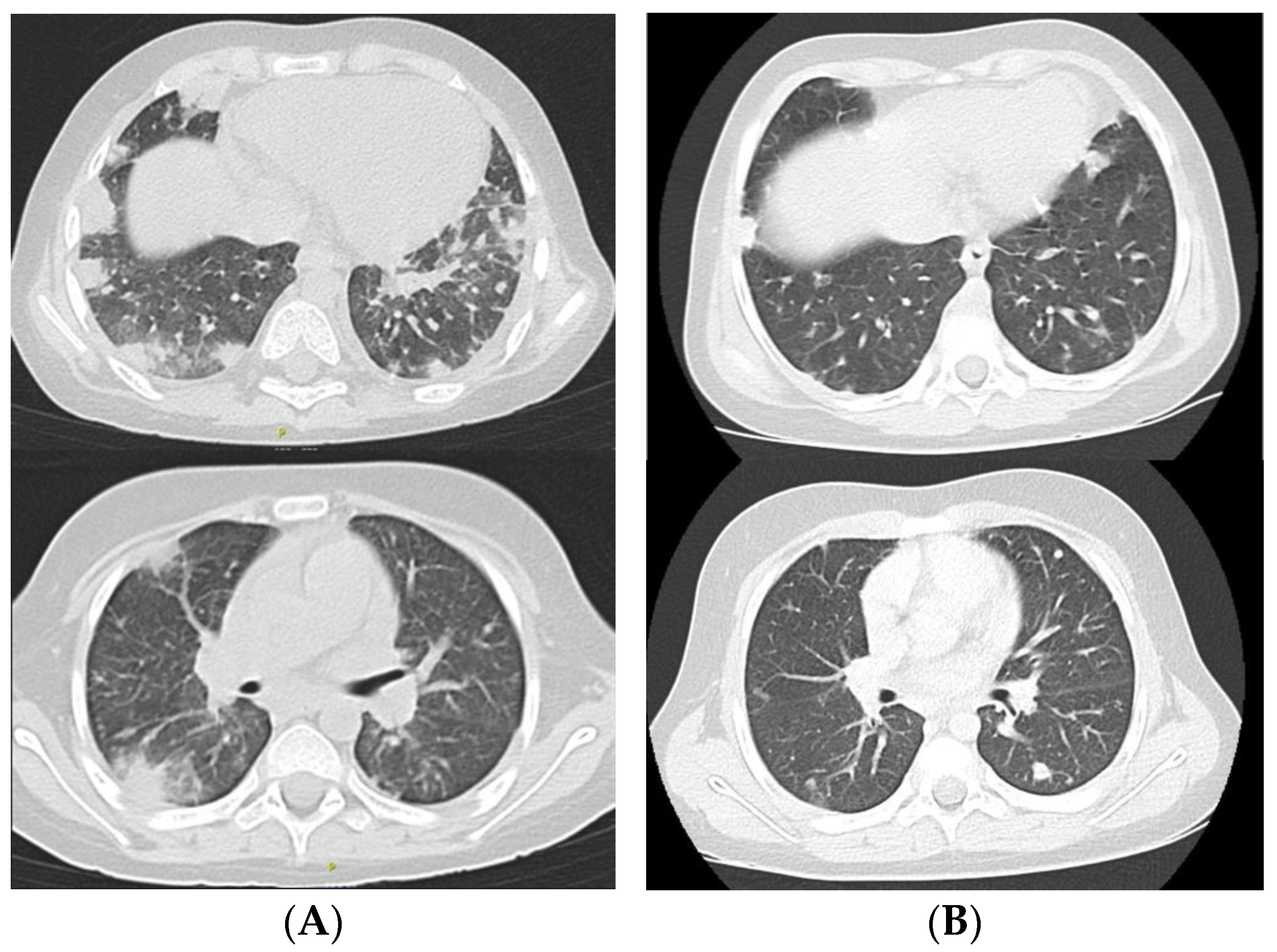 Pathogens 13 00772 g001