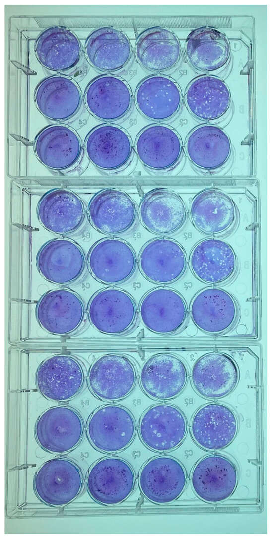 Pathogens 13 00831 g0a1