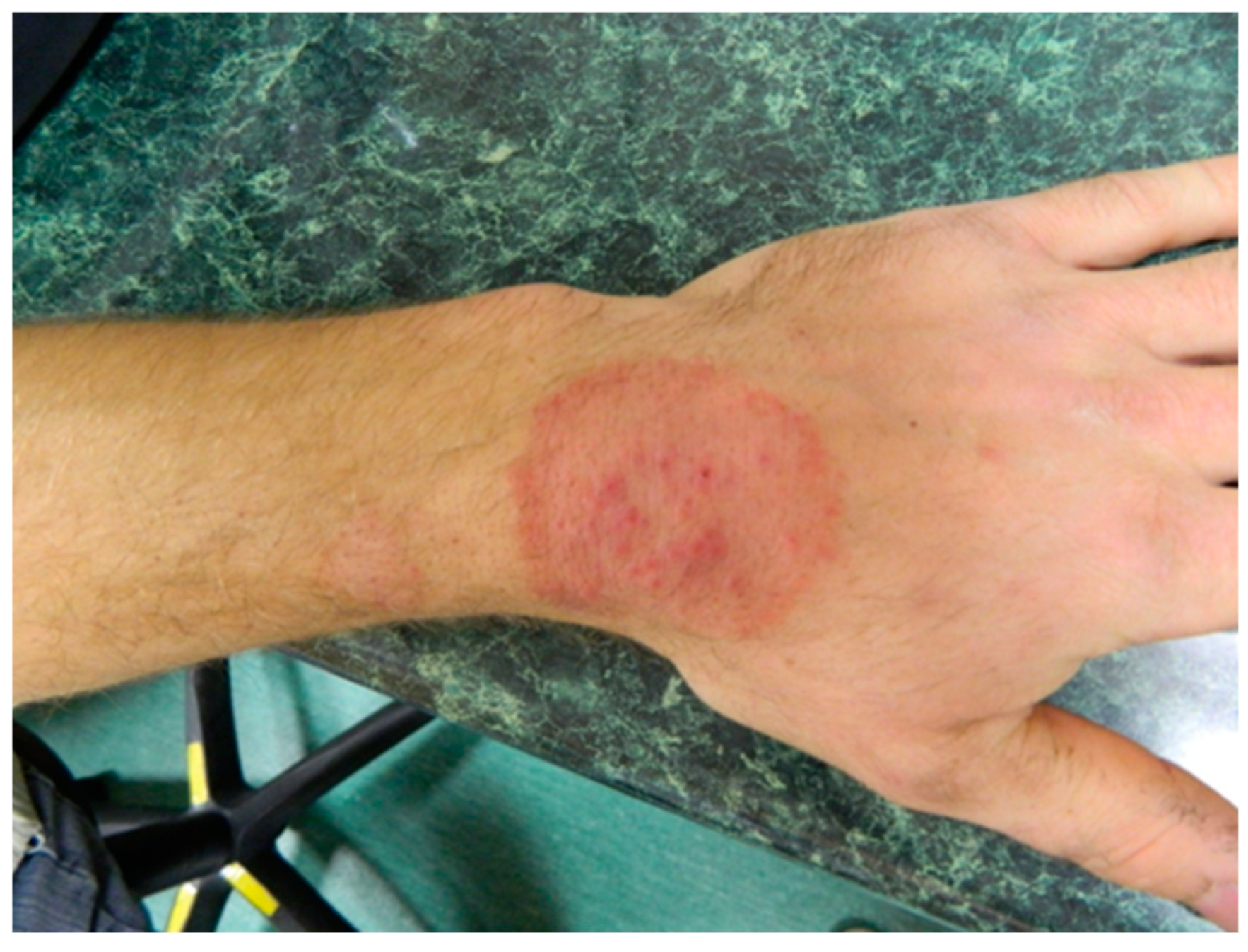 Pathogens 13 00848 g003