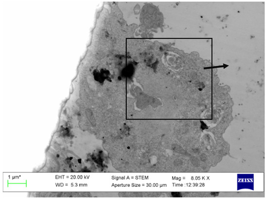 Pathogens 13 00852 g0s1