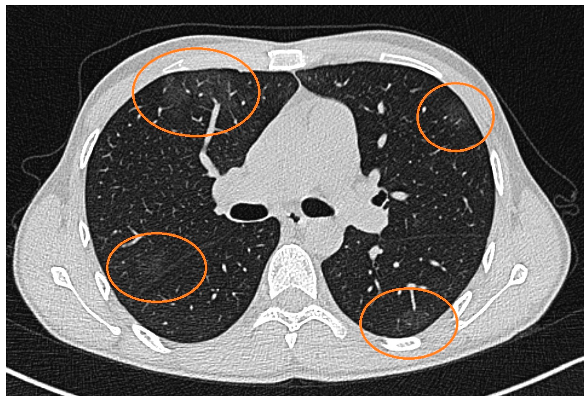 Pathogens 13 00938 g002